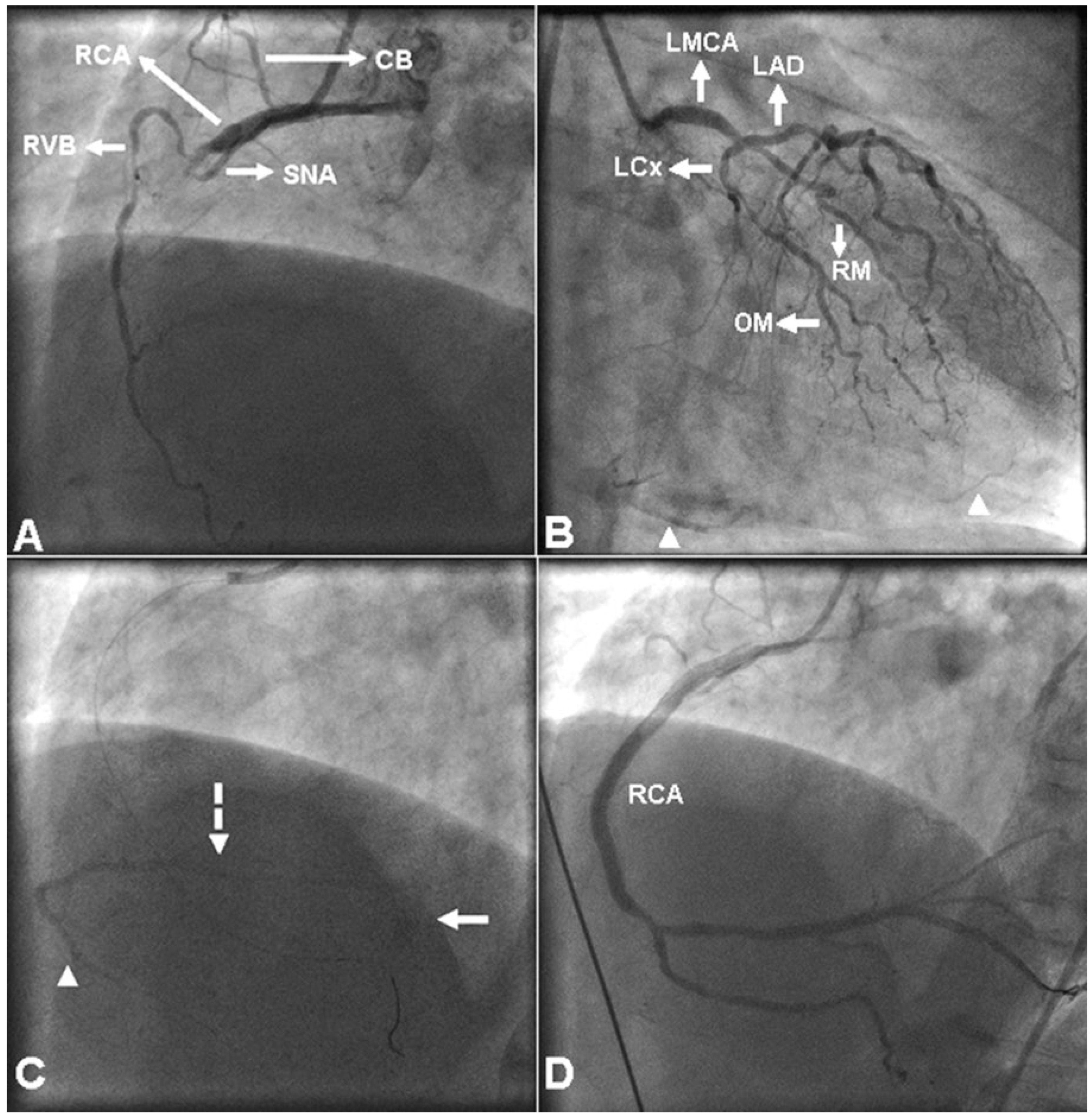 Cardiovascmed 20 00497 g001