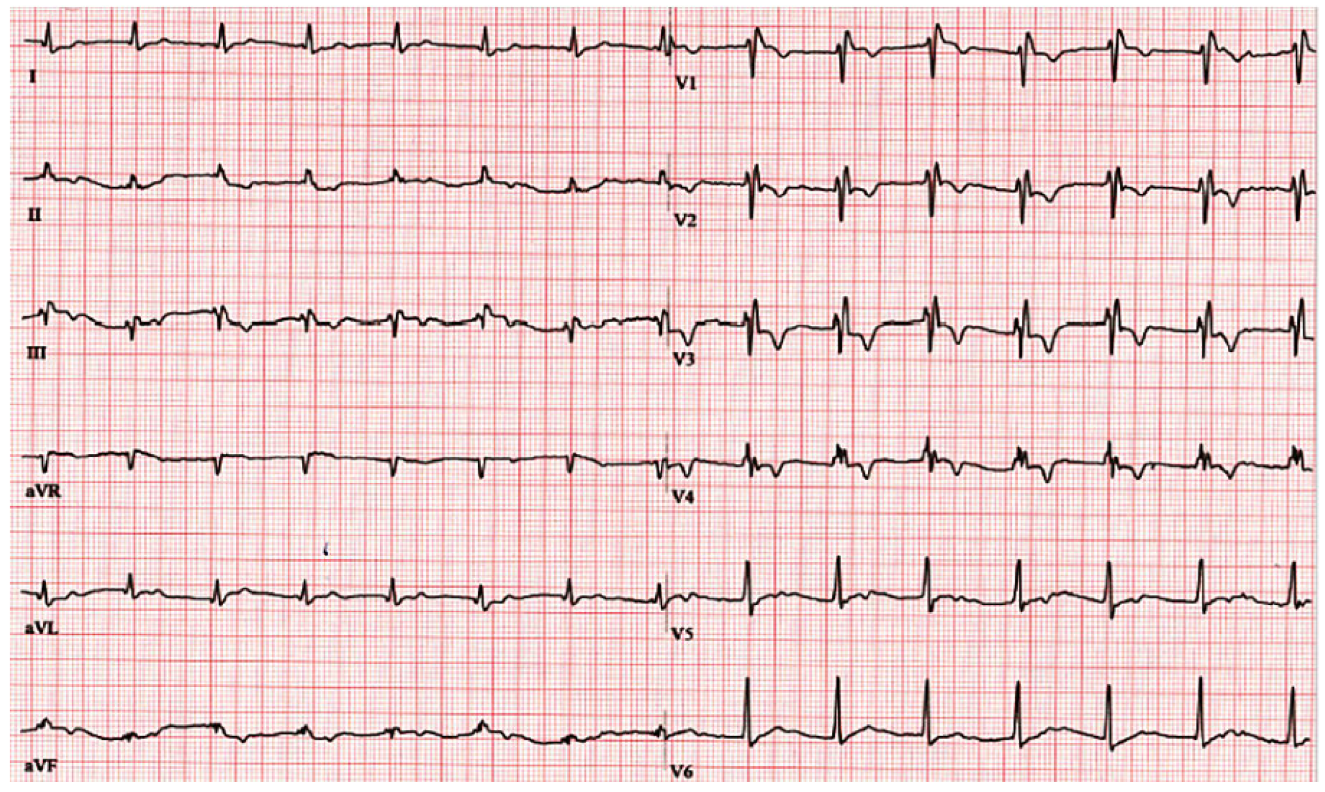 Cardiovascmed 20 00498 g003