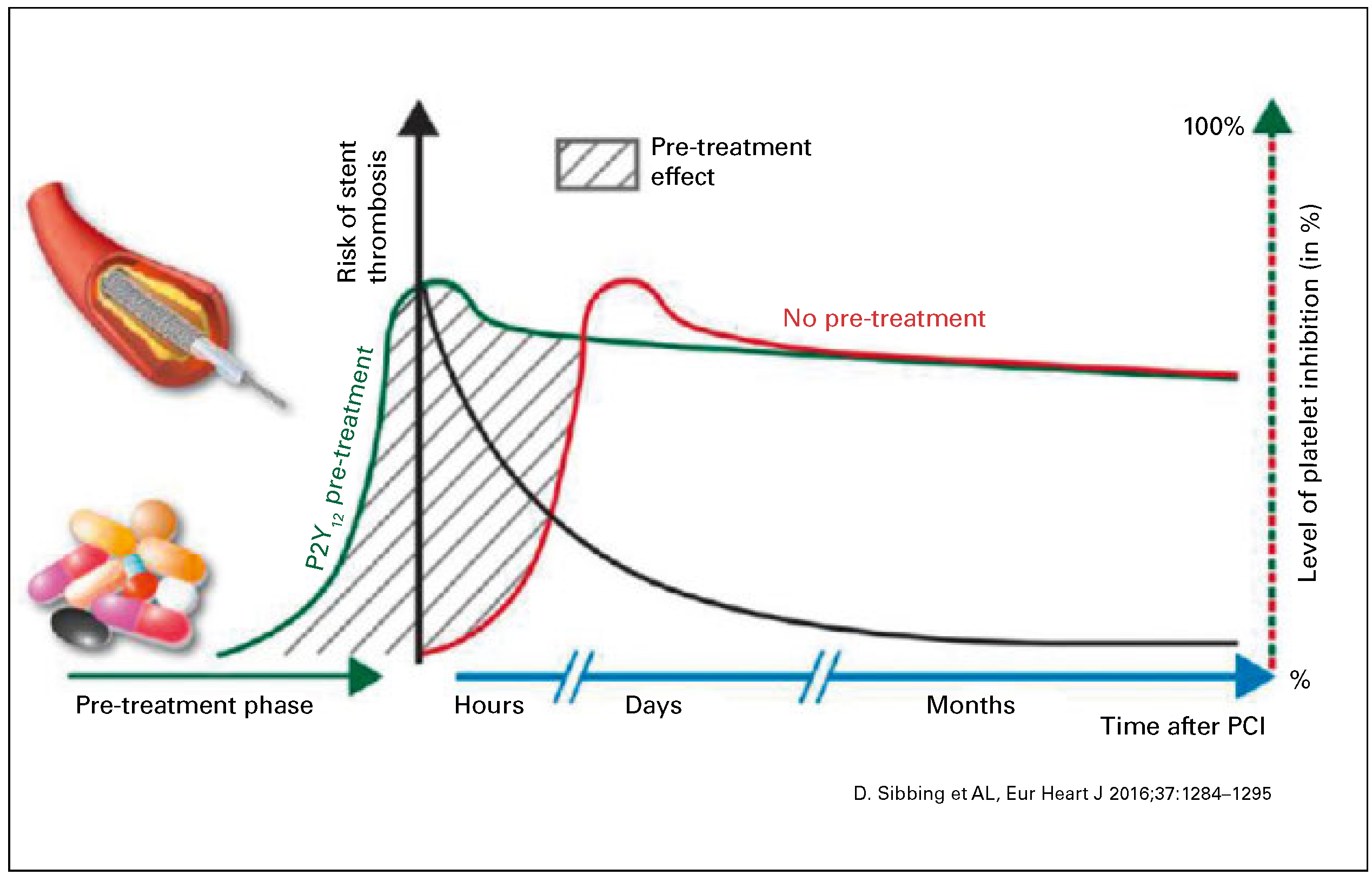 Cardiovascmed 20 00499 g003 Cardiovascmed 20 00499 g003