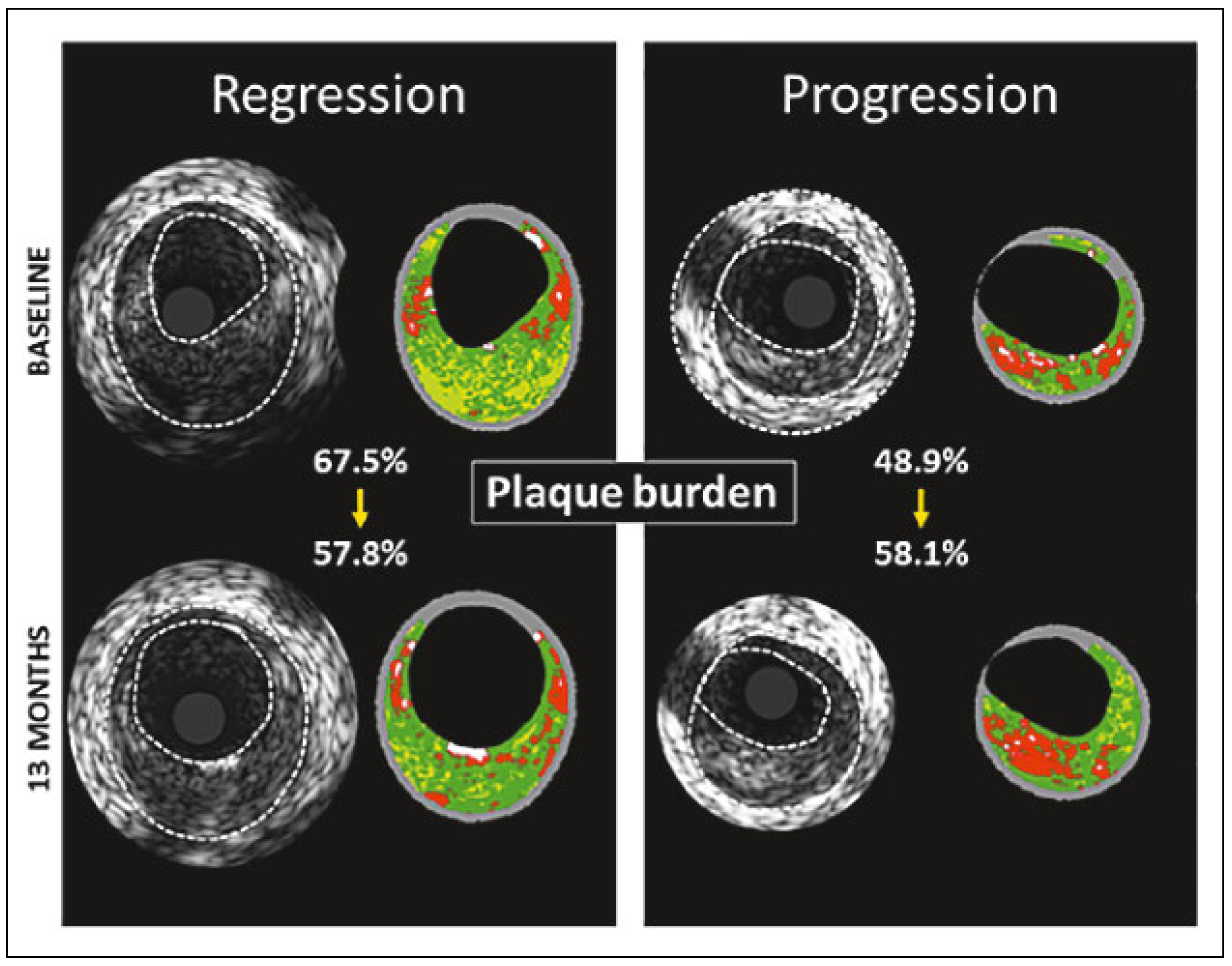 Cardiovascmed 20 00518 g001 Cardiovascmed 20 00518 g001
