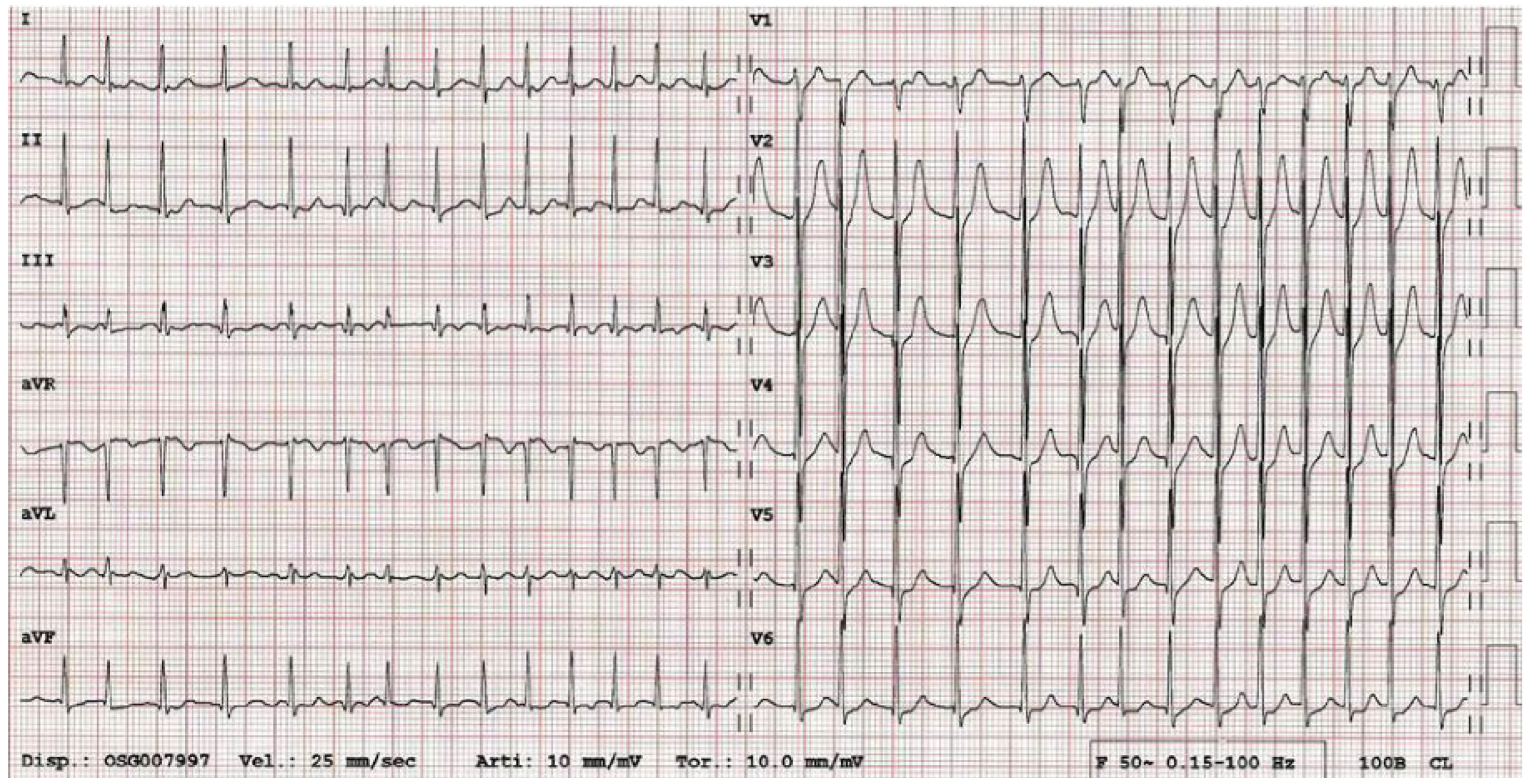 Cardiovascmed 21 00053 g001