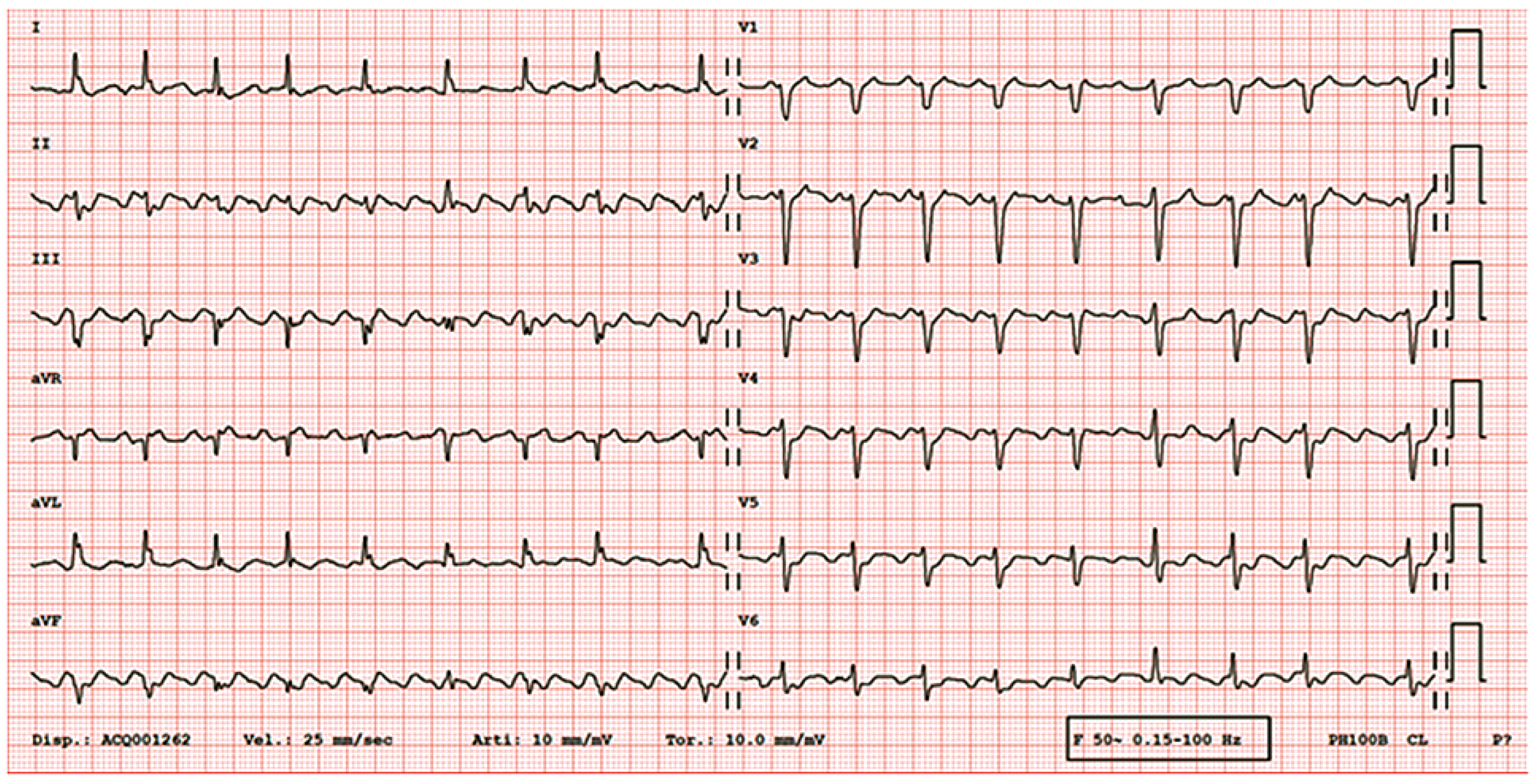 Cardiovascmed 21 00078 g001 Cardiovascmed 21 00078 g001