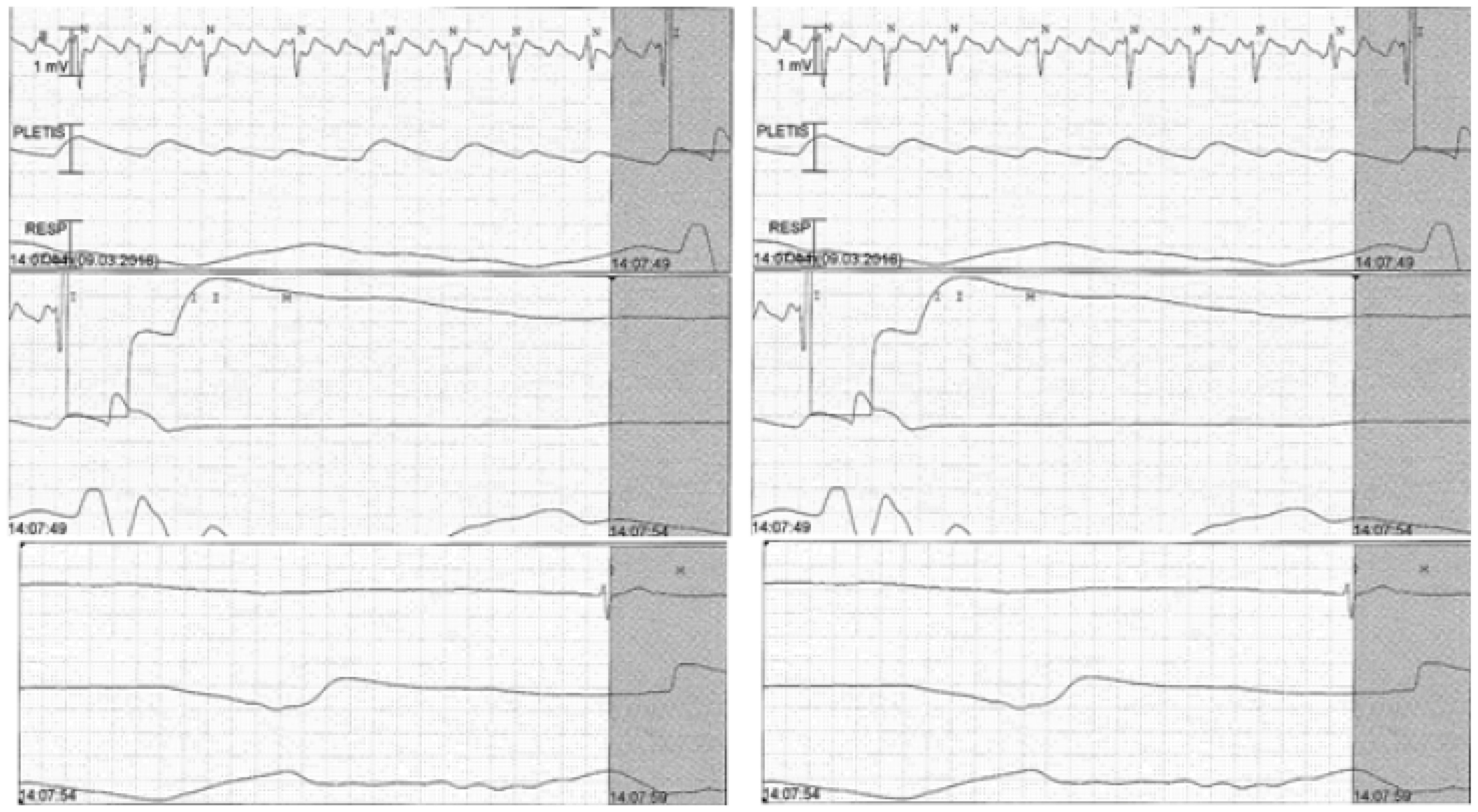 Cardiovascmed 21 00078 g002 Cardiovascmed 21 00078 g002