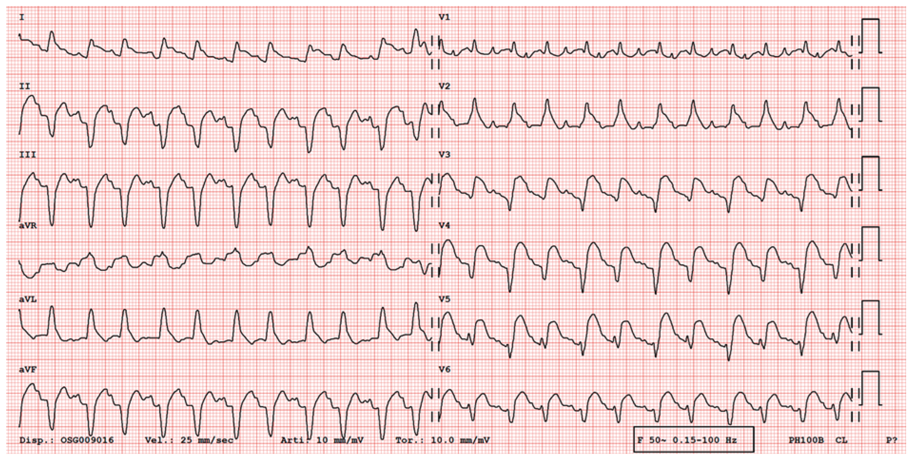 Cardiovascmed 21 00078 g003 Cardiovascmed 21 00078 g003