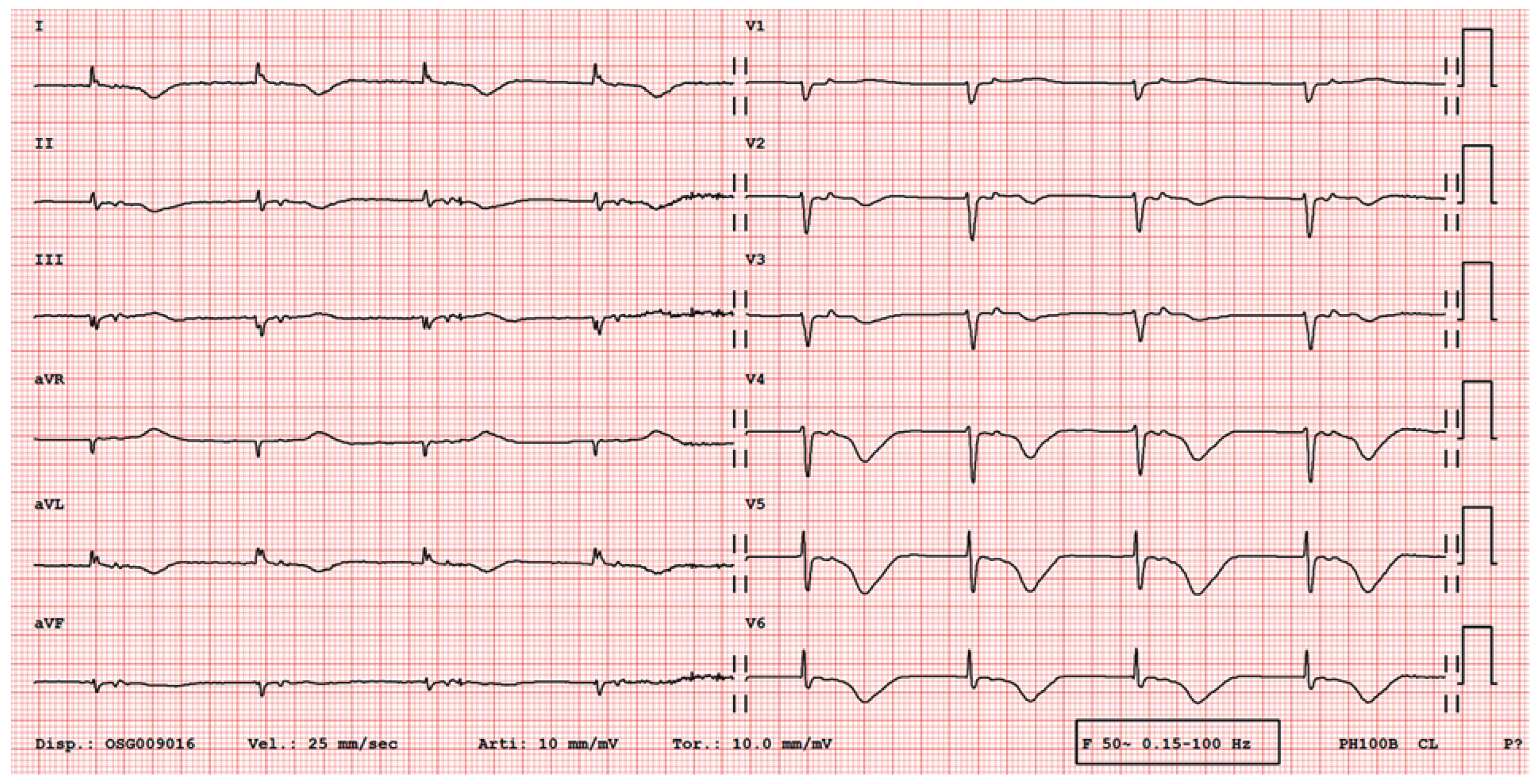 Cardiovascmed 21 00078 g005 Cardiovascmed 21 00078 g005