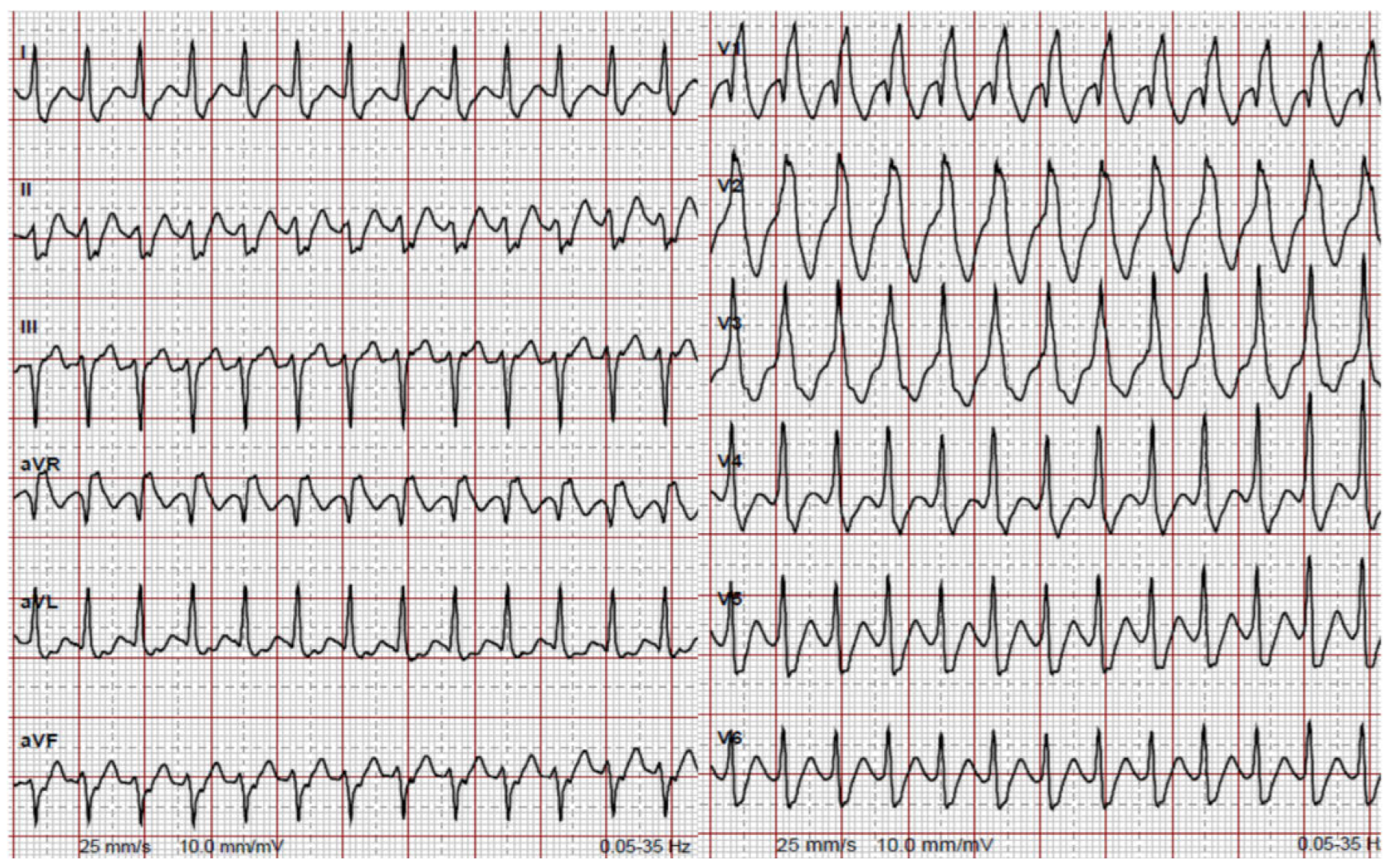 Cardiovascmed 21 00090 g001