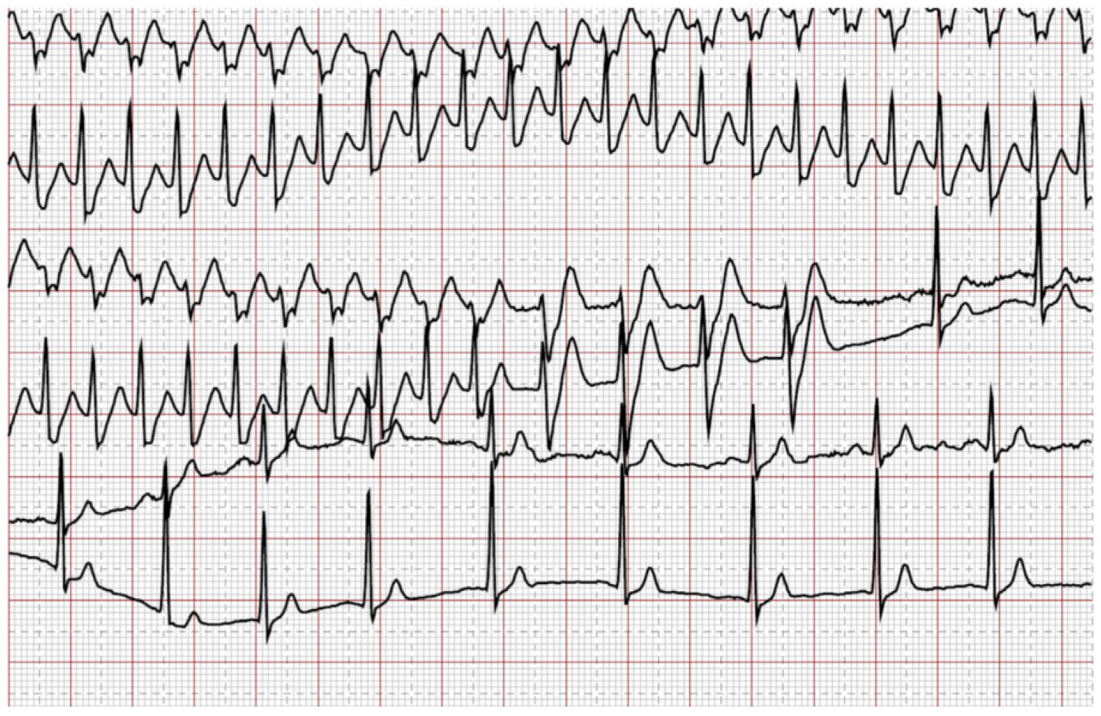 Cardiovascmed 21 00090 g006
