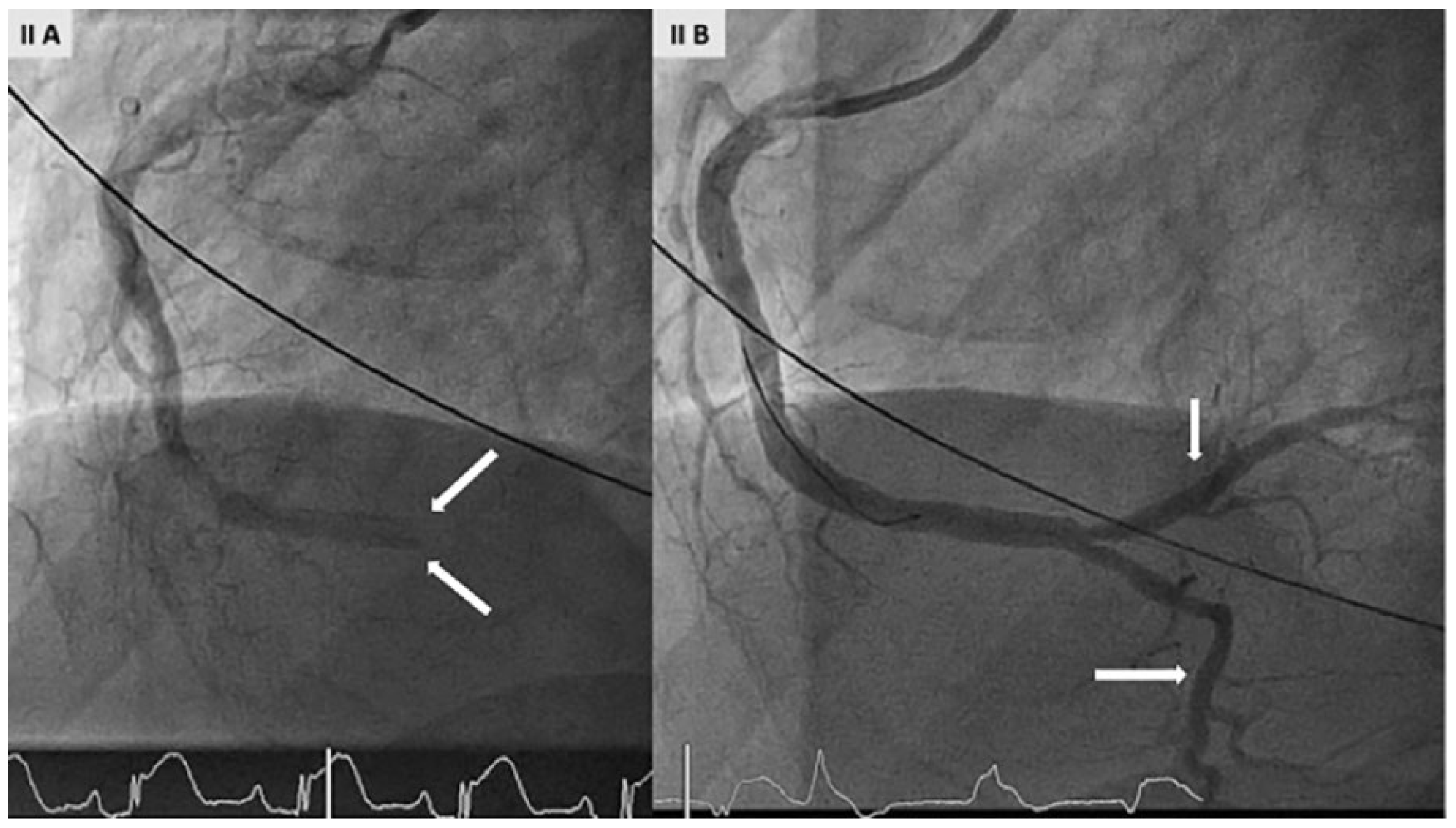 Cardiovascmed 21 00166 g002