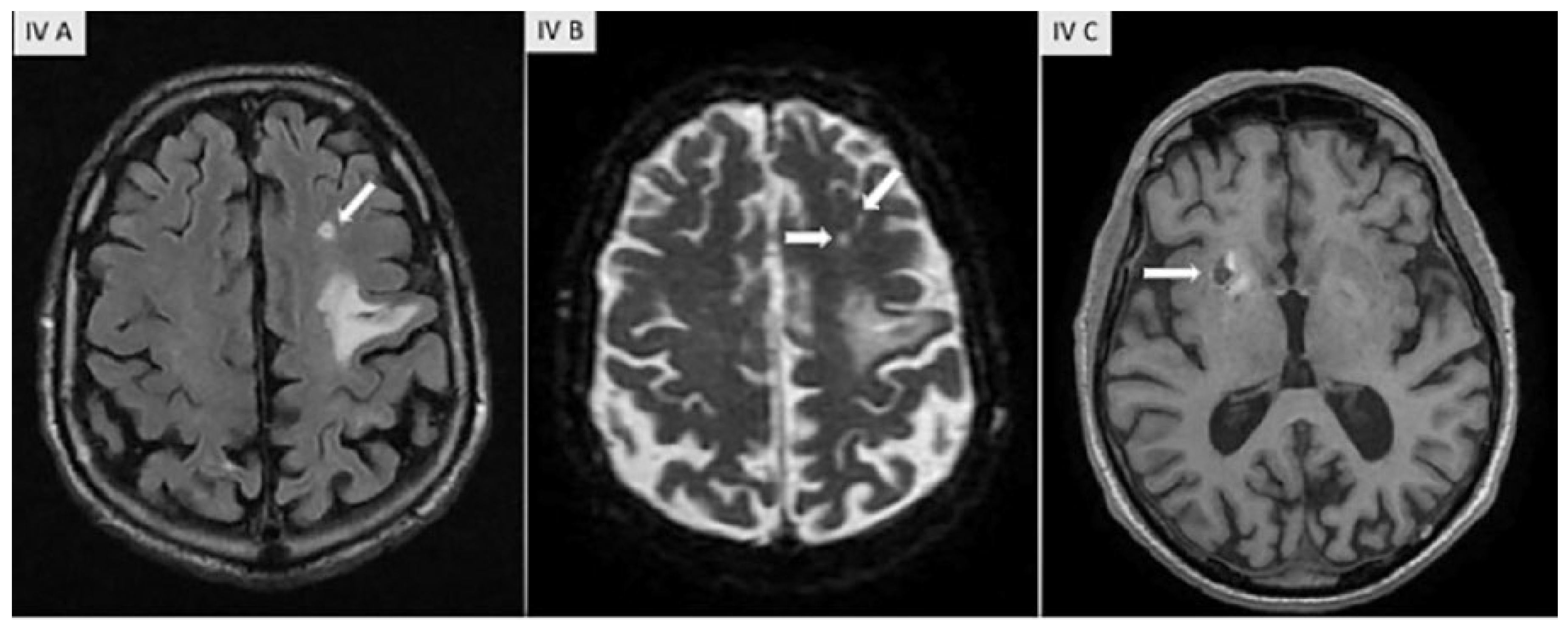 Cardiovascmed 21 00166 g004
