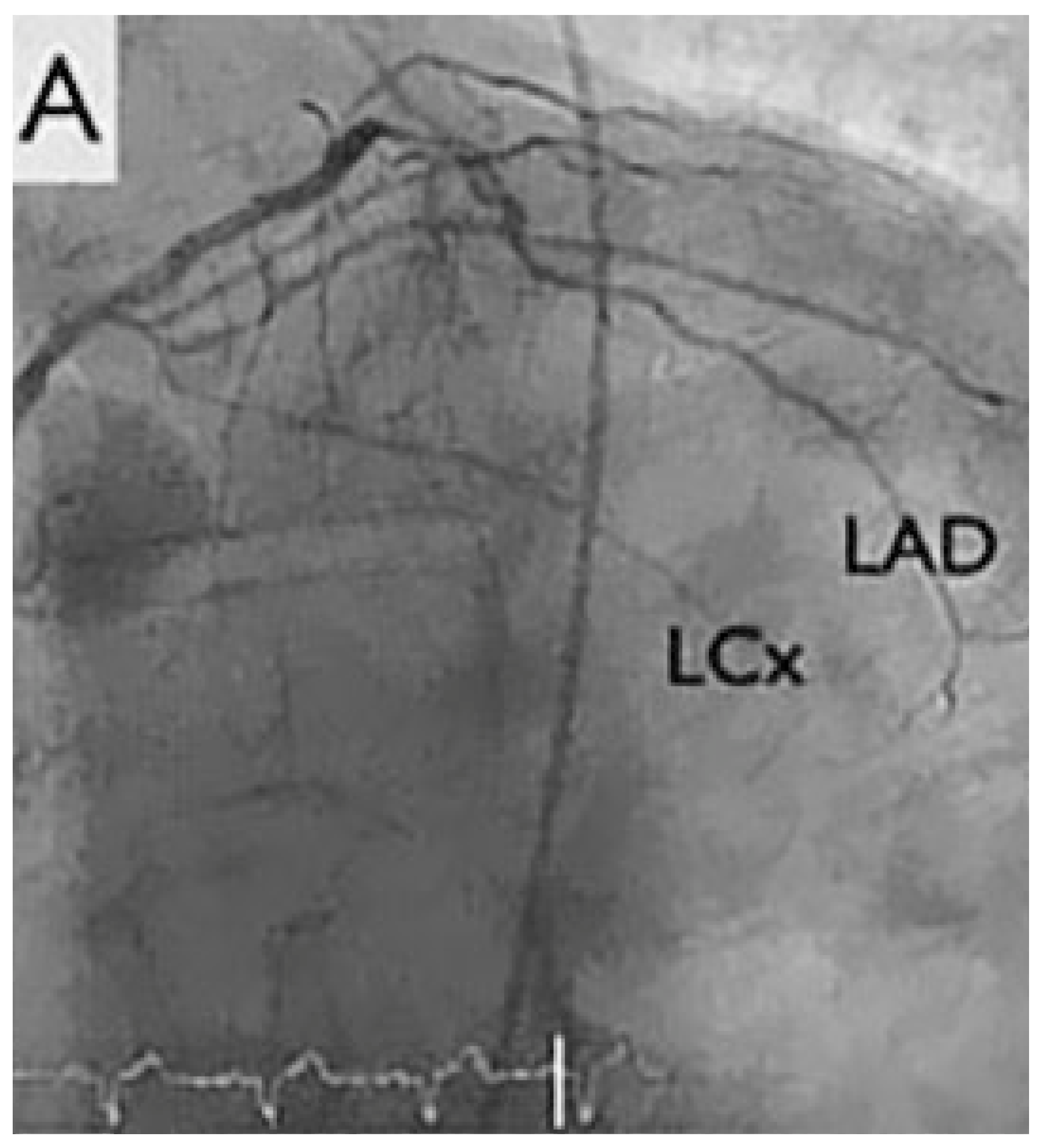 Cardiovascmed 21 00170 g001a