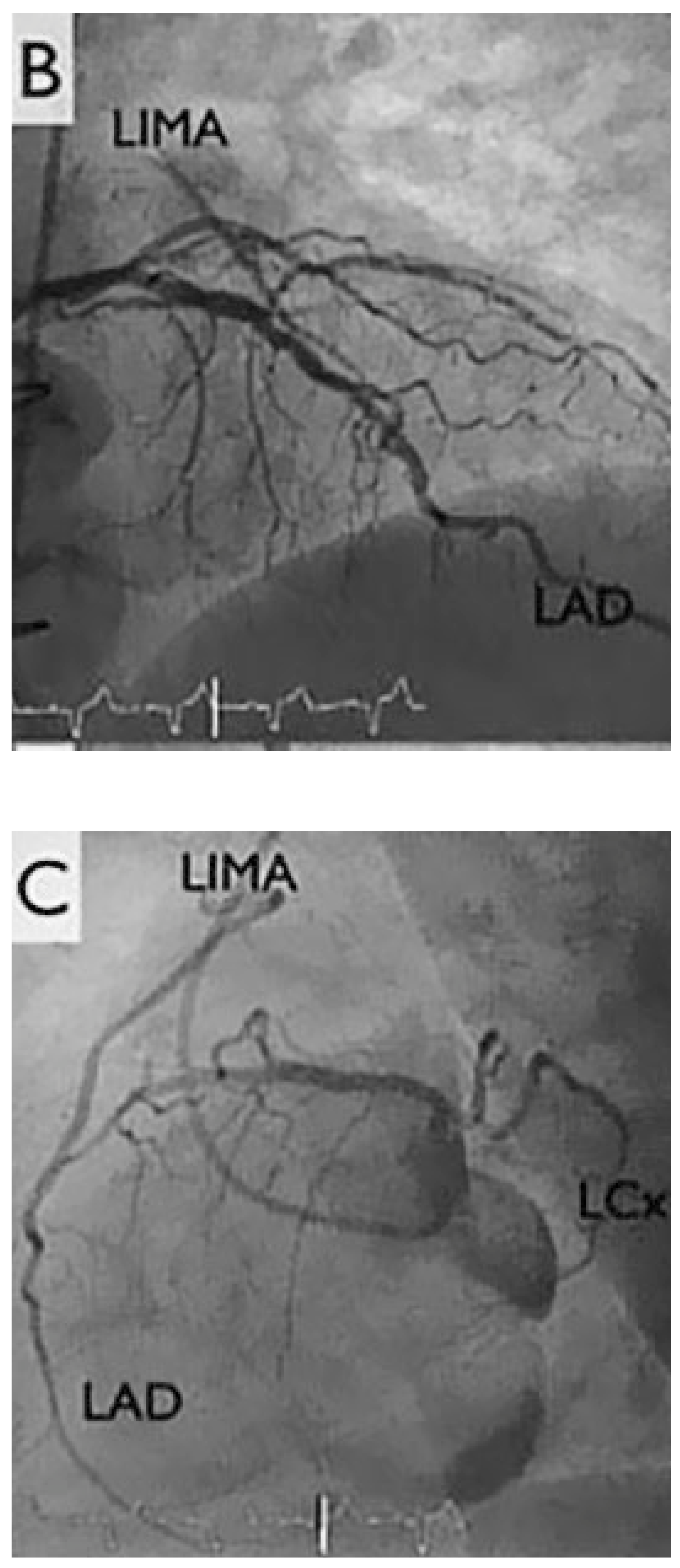 Cardiovascmed 21 00170 g001b