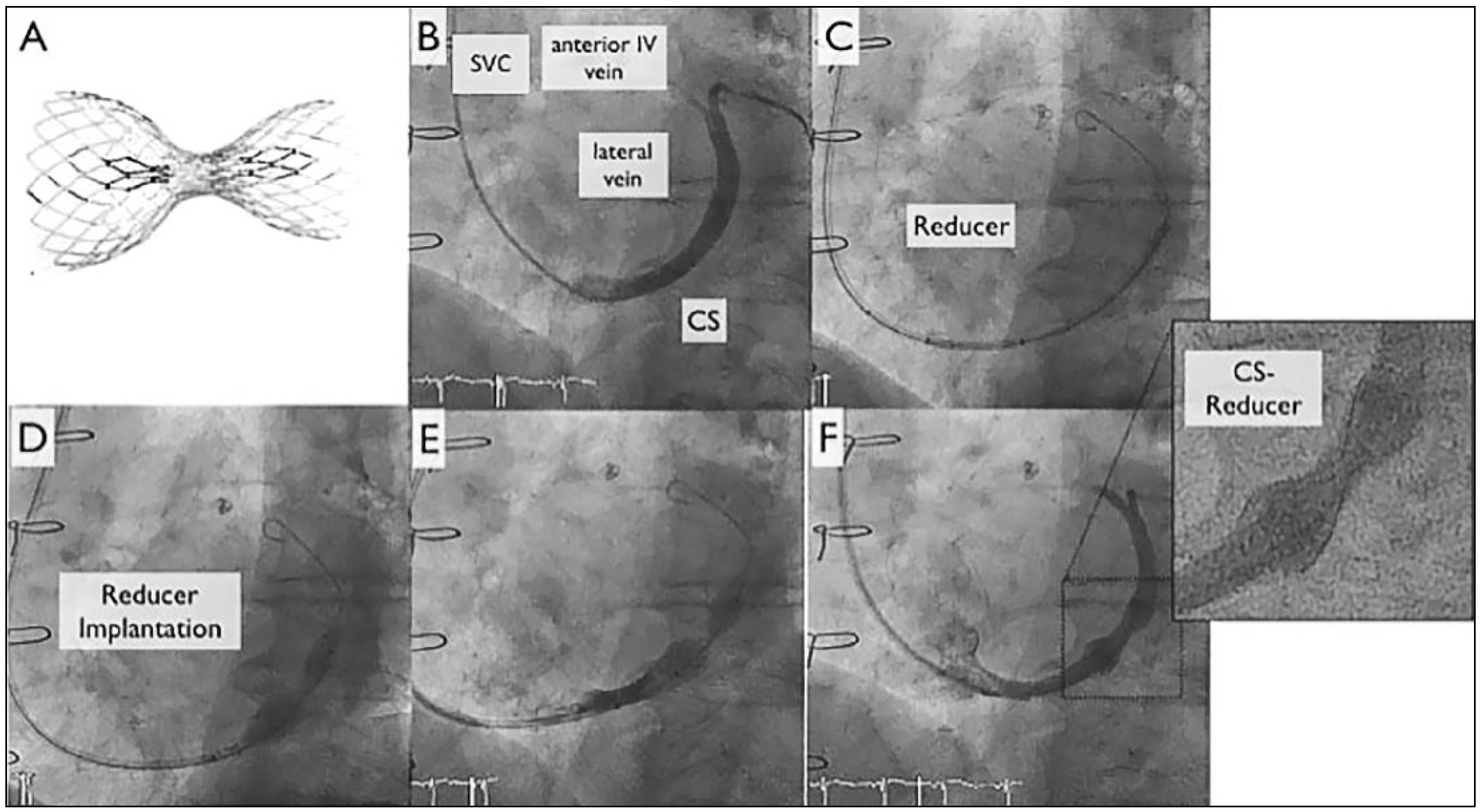 Cardiovascmed 21 00170 g002