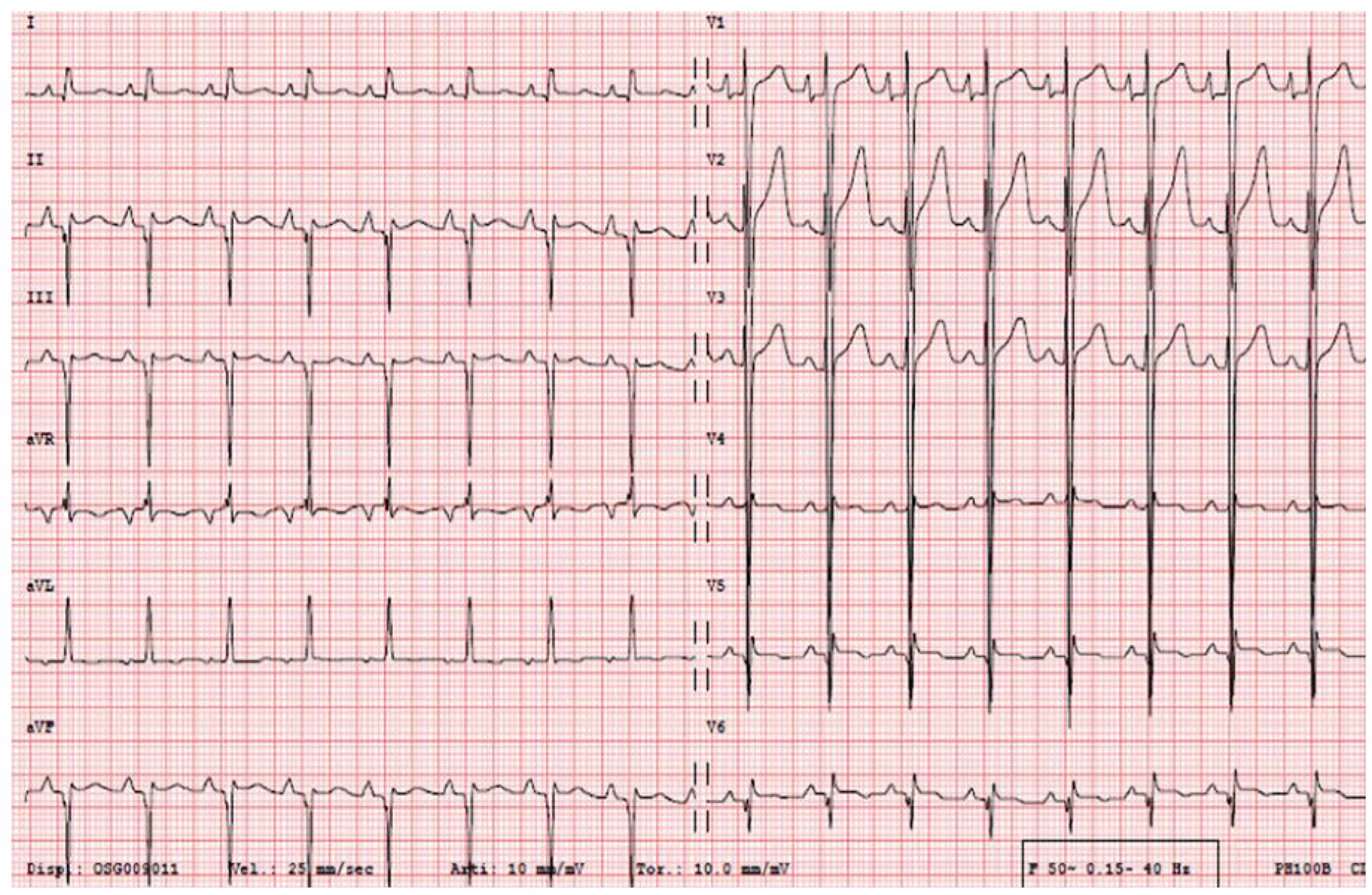 Cardiovascmed 21 00174 g002 Cardiovascmed 21 00174 g002