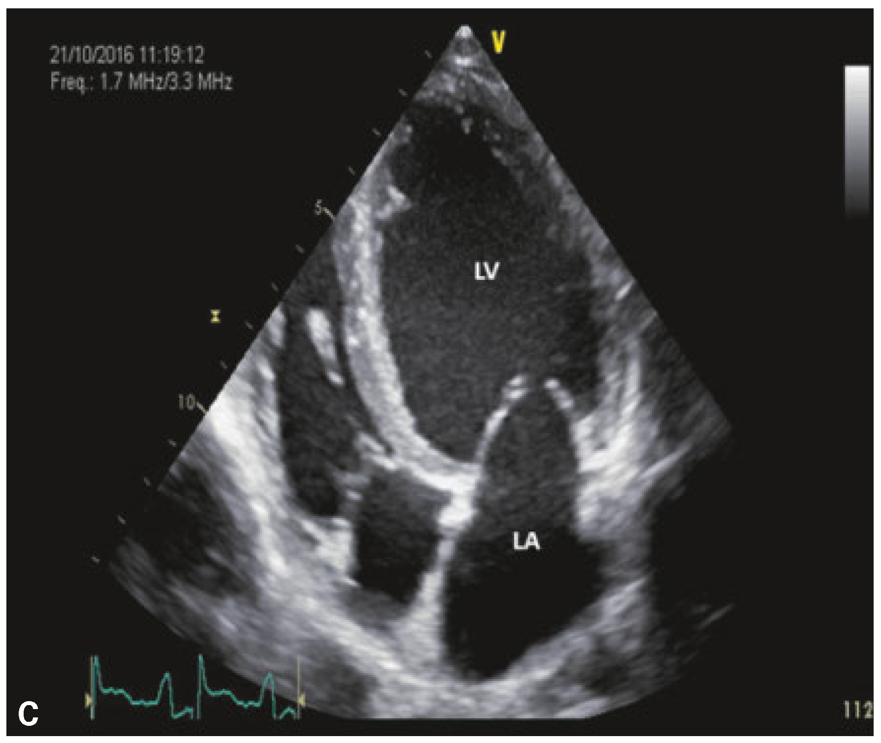 Cardiovascmed 21 00174 g003 Cardiovascmed 21 00174 g003