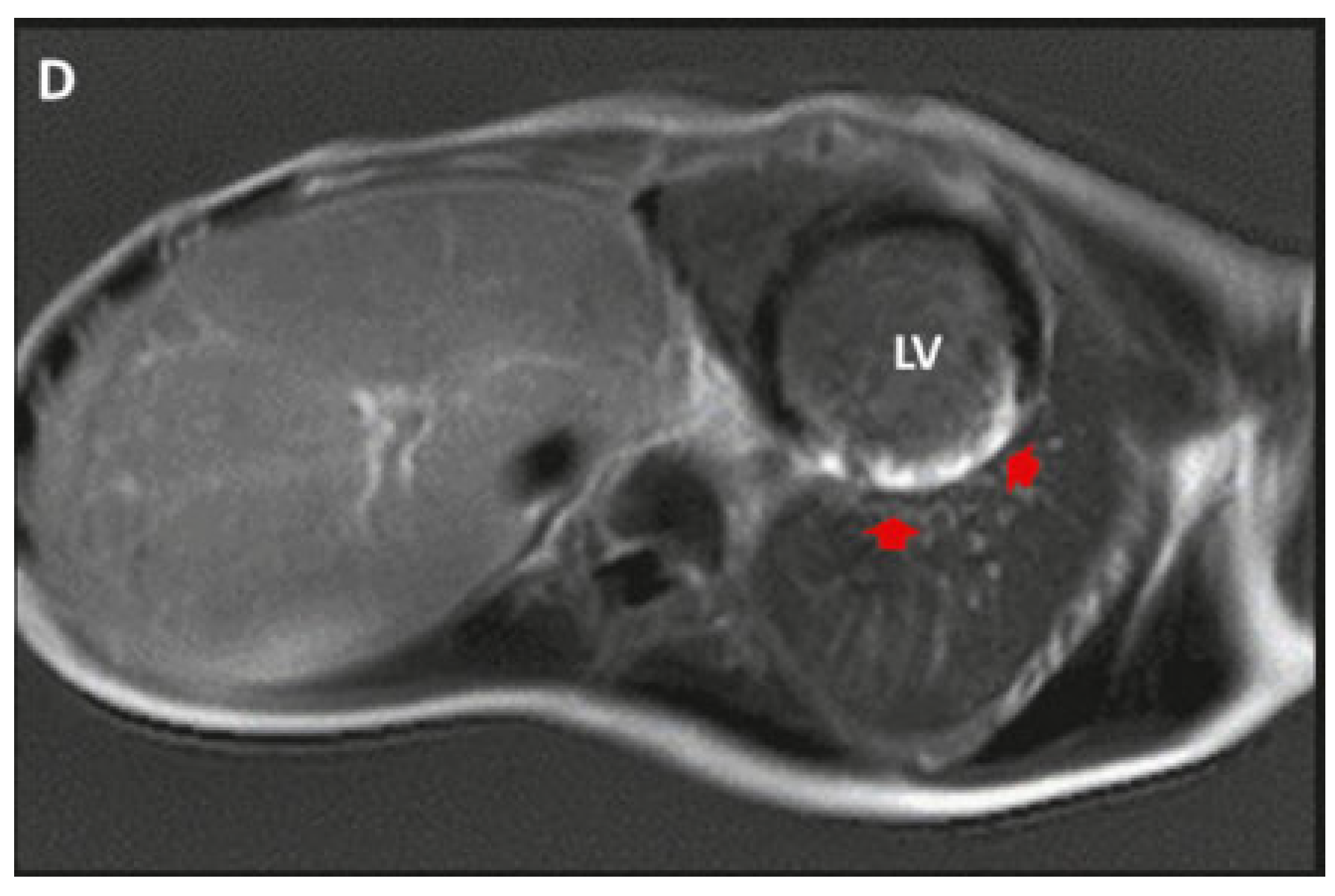 Cardiovascmed 21 00174 g004 Cardiovascmed 21 00174 g004