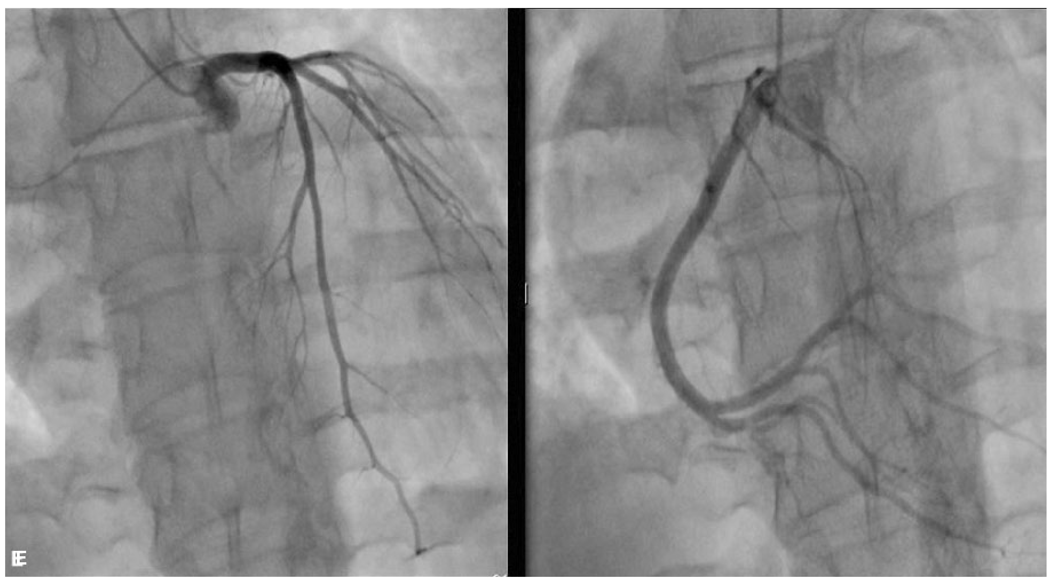 Cardiovascmed 21 00174 g005 Cardiovascmed 21 00174 g005
