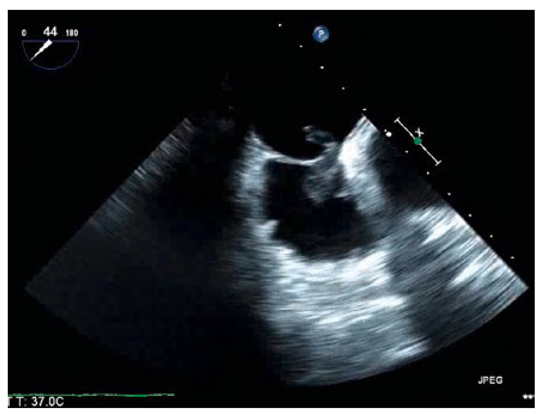 Cardiovascmed 21 00200 g001 Cardiovascmed 21 00200 g001