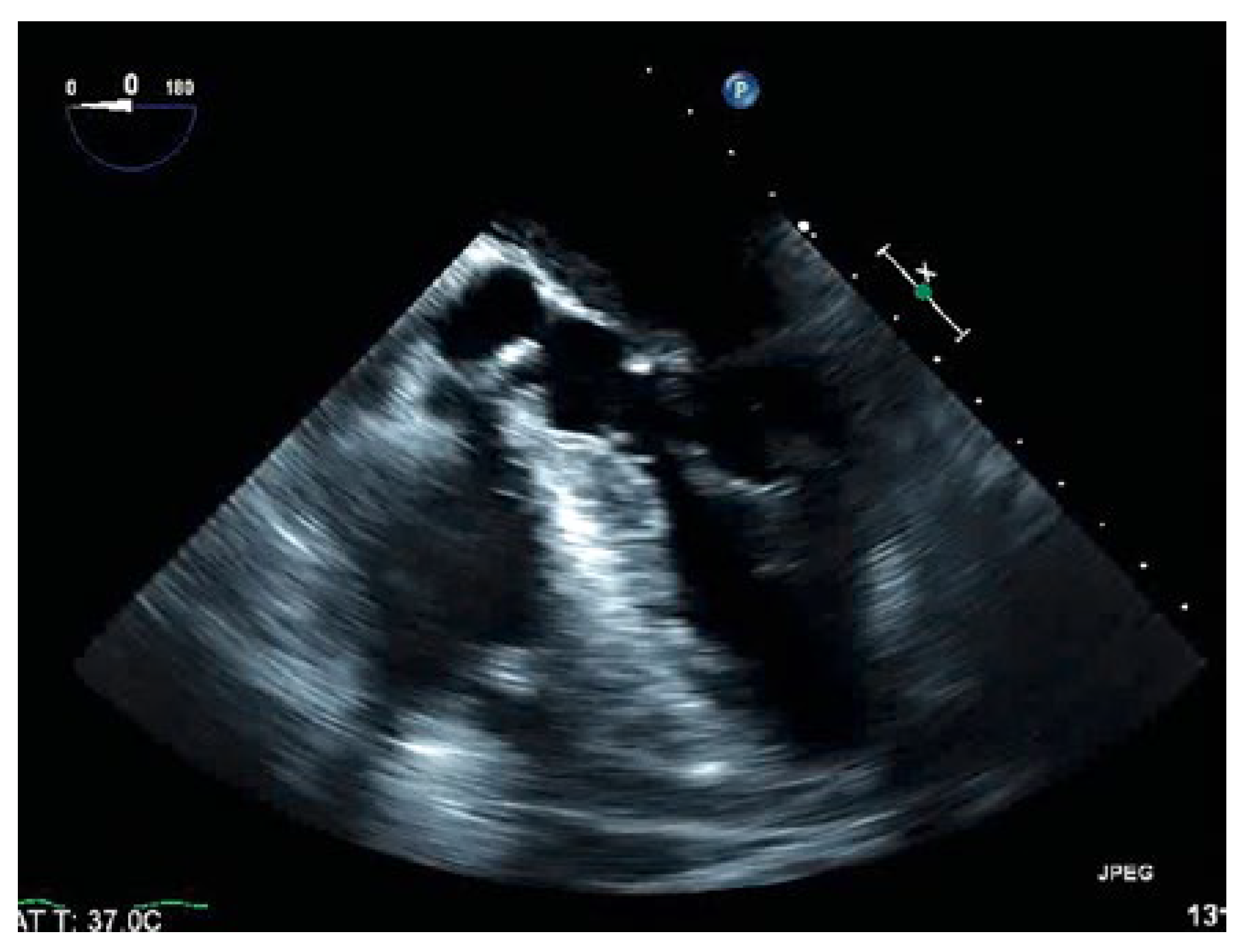 Cardiovascmed 21 00200 g002 Cardiovascmed 21 00200 g002