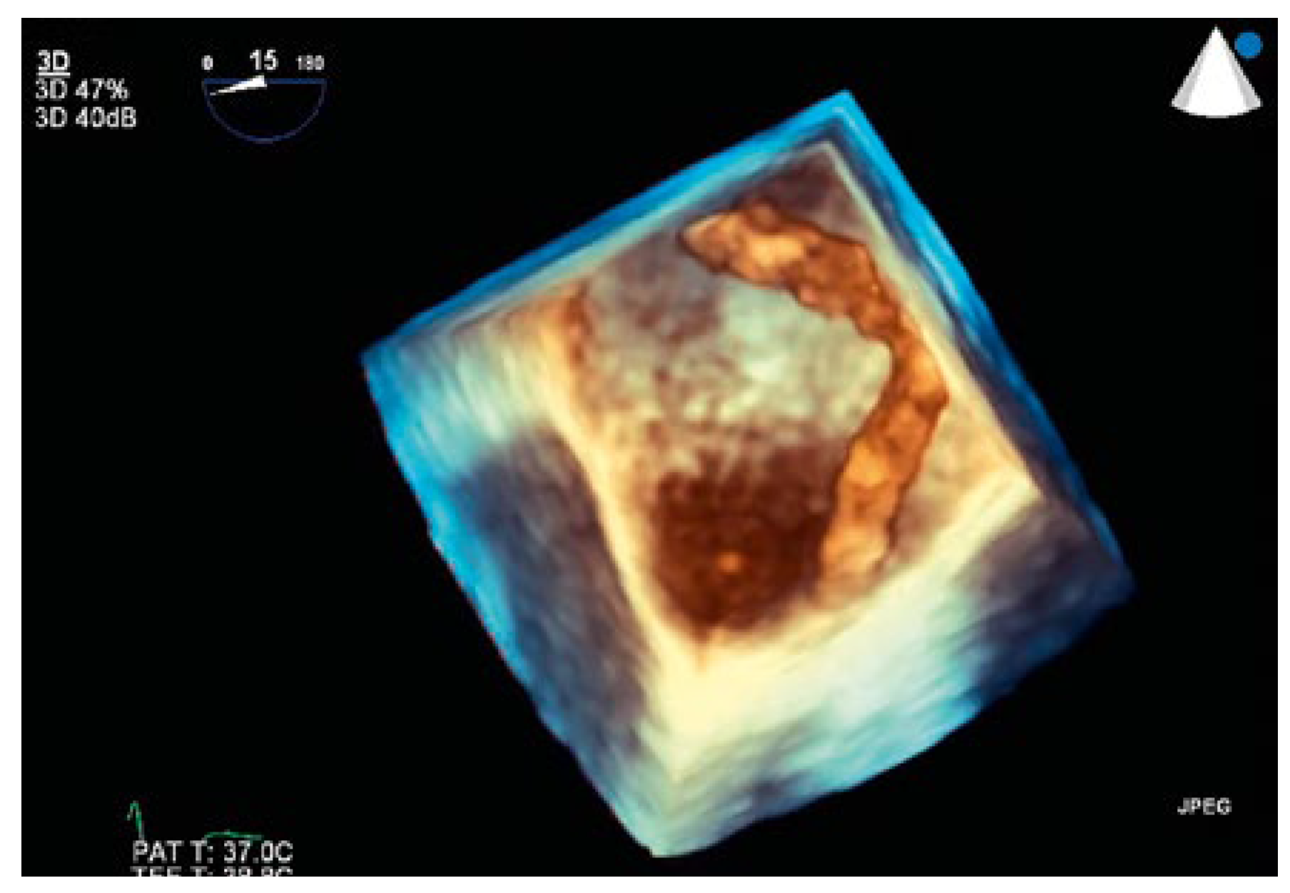 Cardiovascmed 21 00200 g004 Cardiovascmed 21 00200 g004