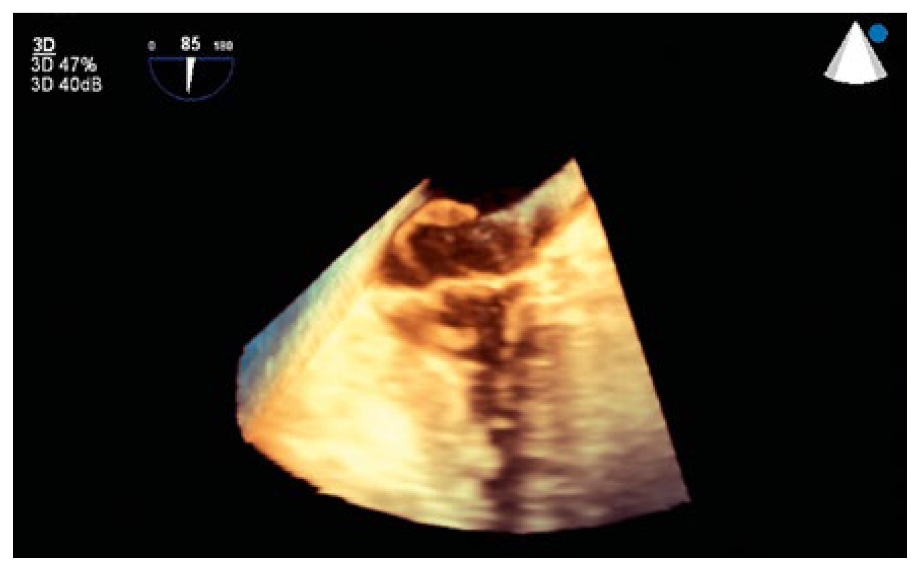 Cardiovascmed 21 00200 g005 Cardiovascmed 21 00200 g005