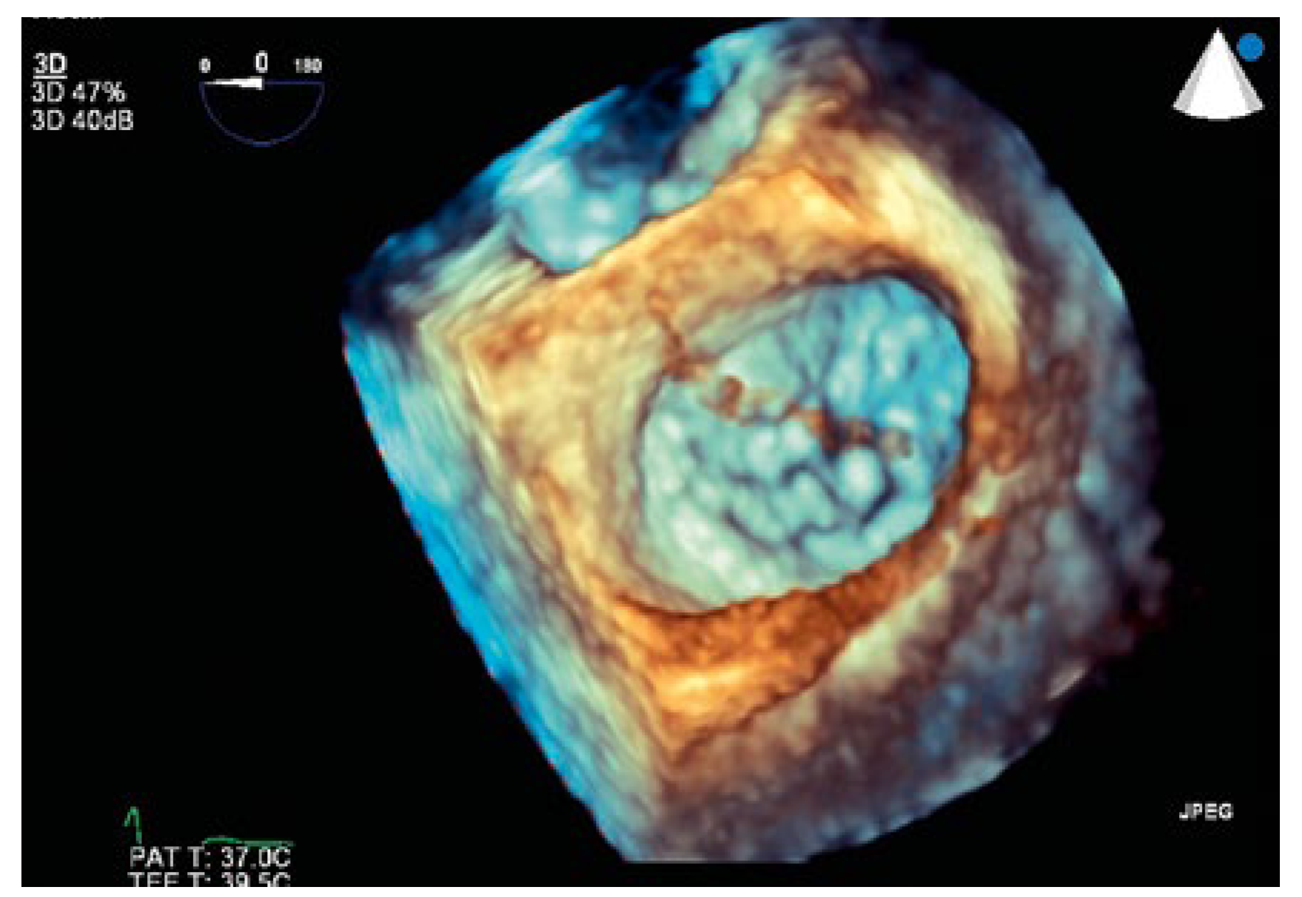 Cardiovascmed 21 00200 g006 Cardiovascmed 21 00200 g006