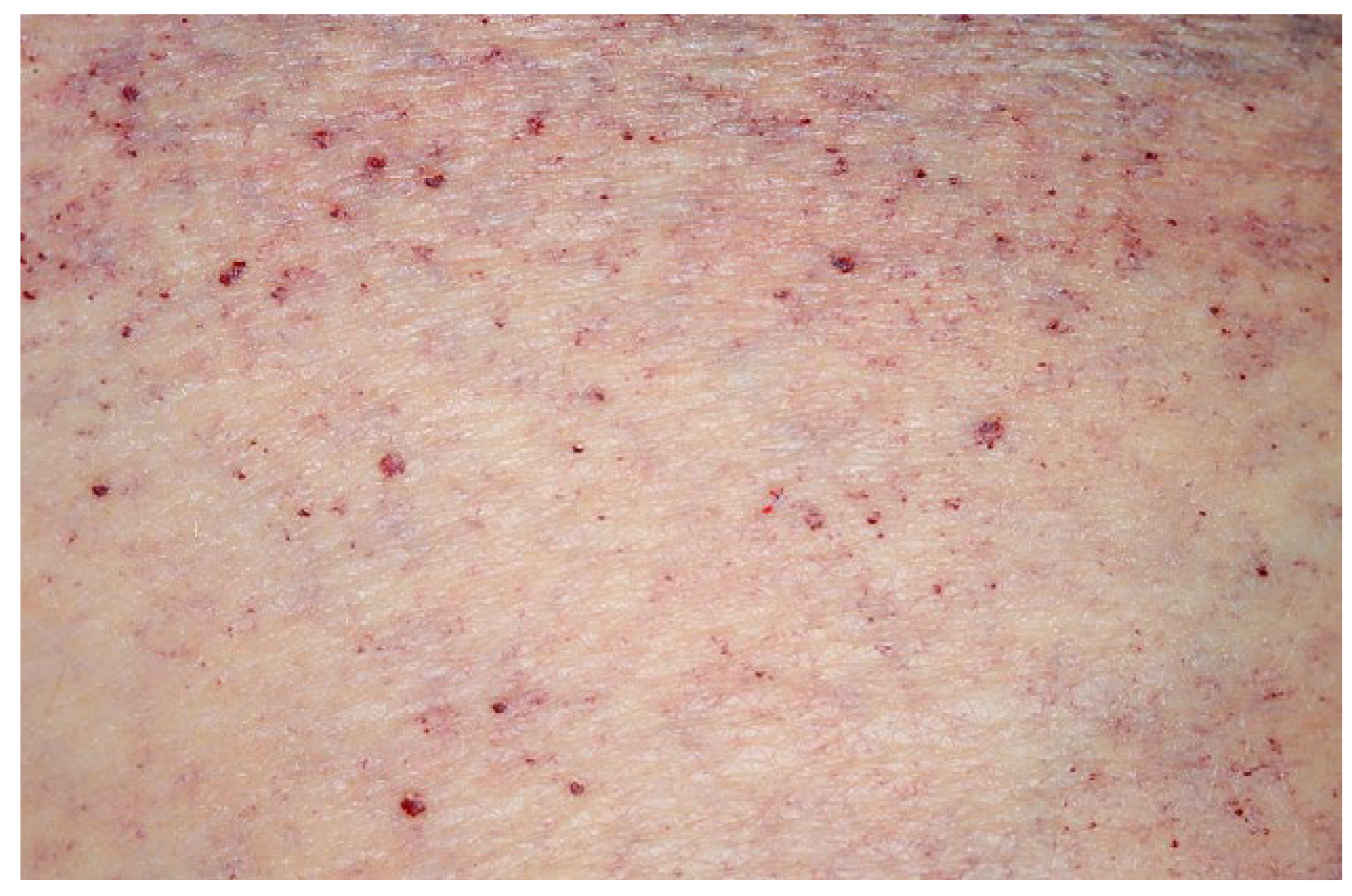 Cardiovascmed 21 00212 g001 Cardiovascmed 21 00212 g001