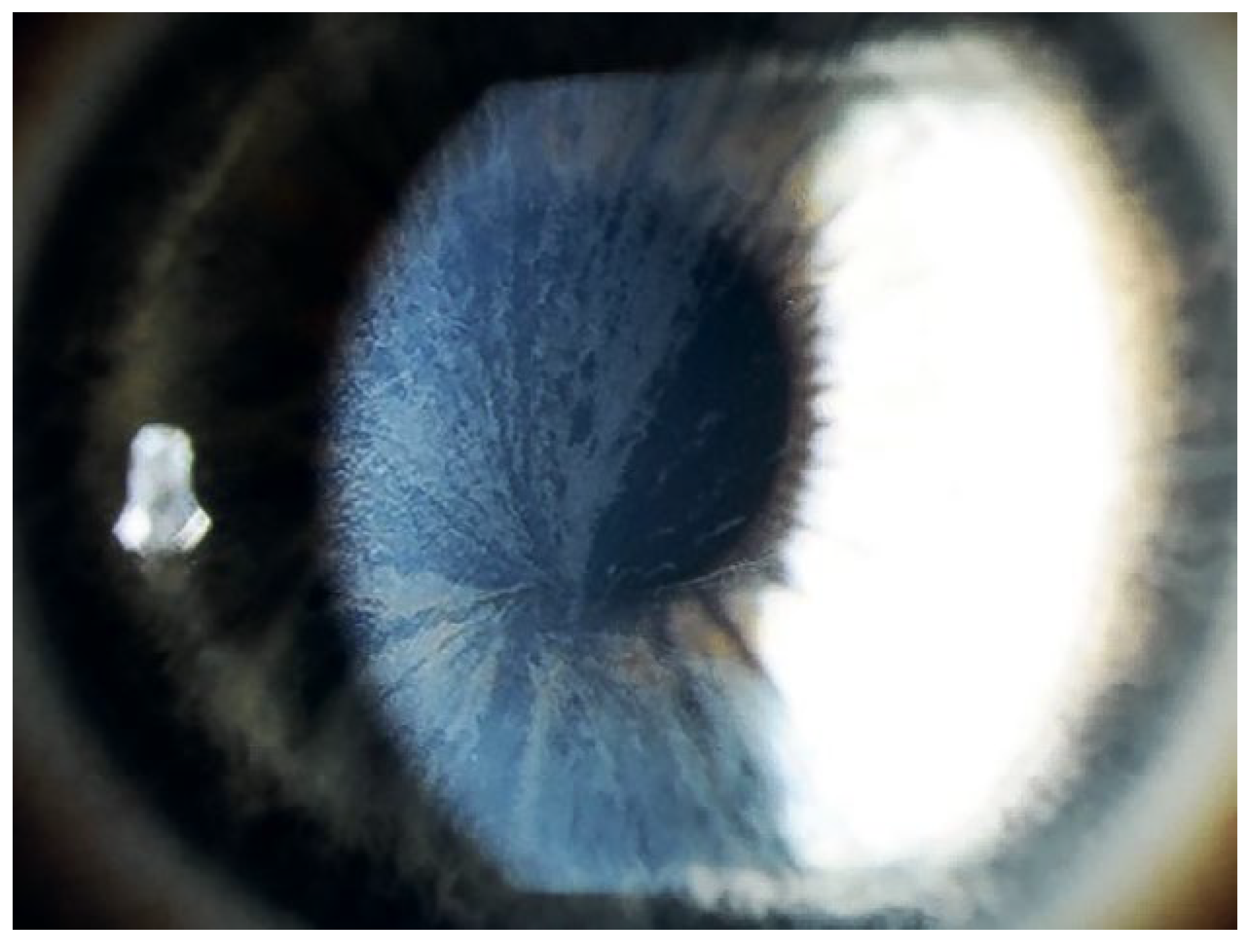 Cardiovascmed 21 00212 g002 Cardiovascmed 21 00212 g002