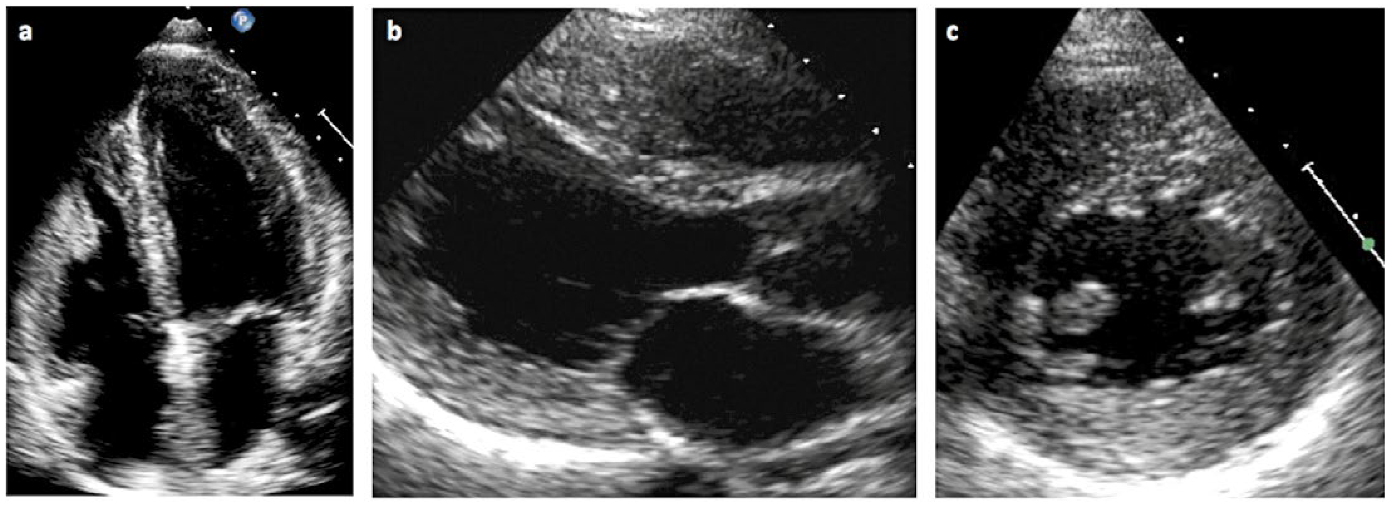 Cardiovascmed 21 00212 g003 Cardiovascmed 21 00212 g003