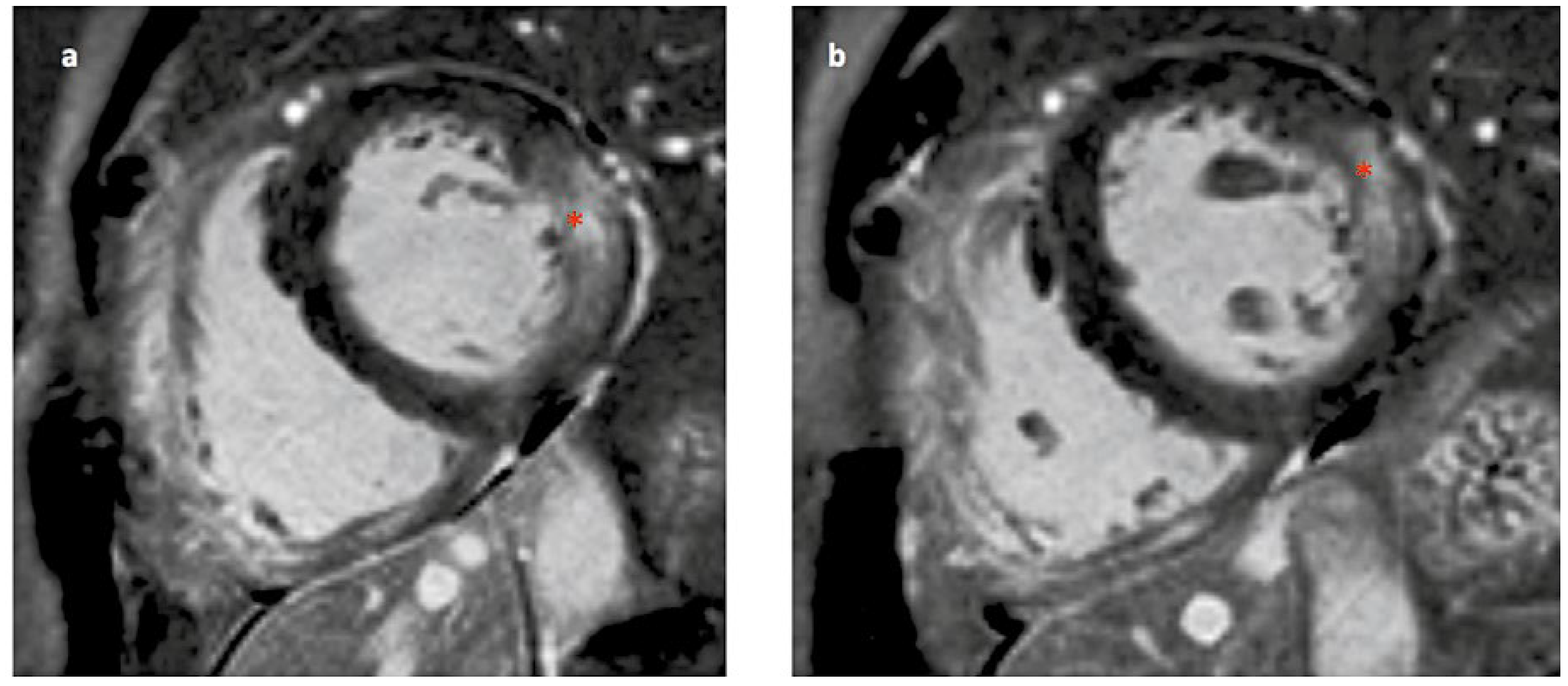 Cardiovascmed 21 00212 g005 Cardiovascmed 21 00212 g005