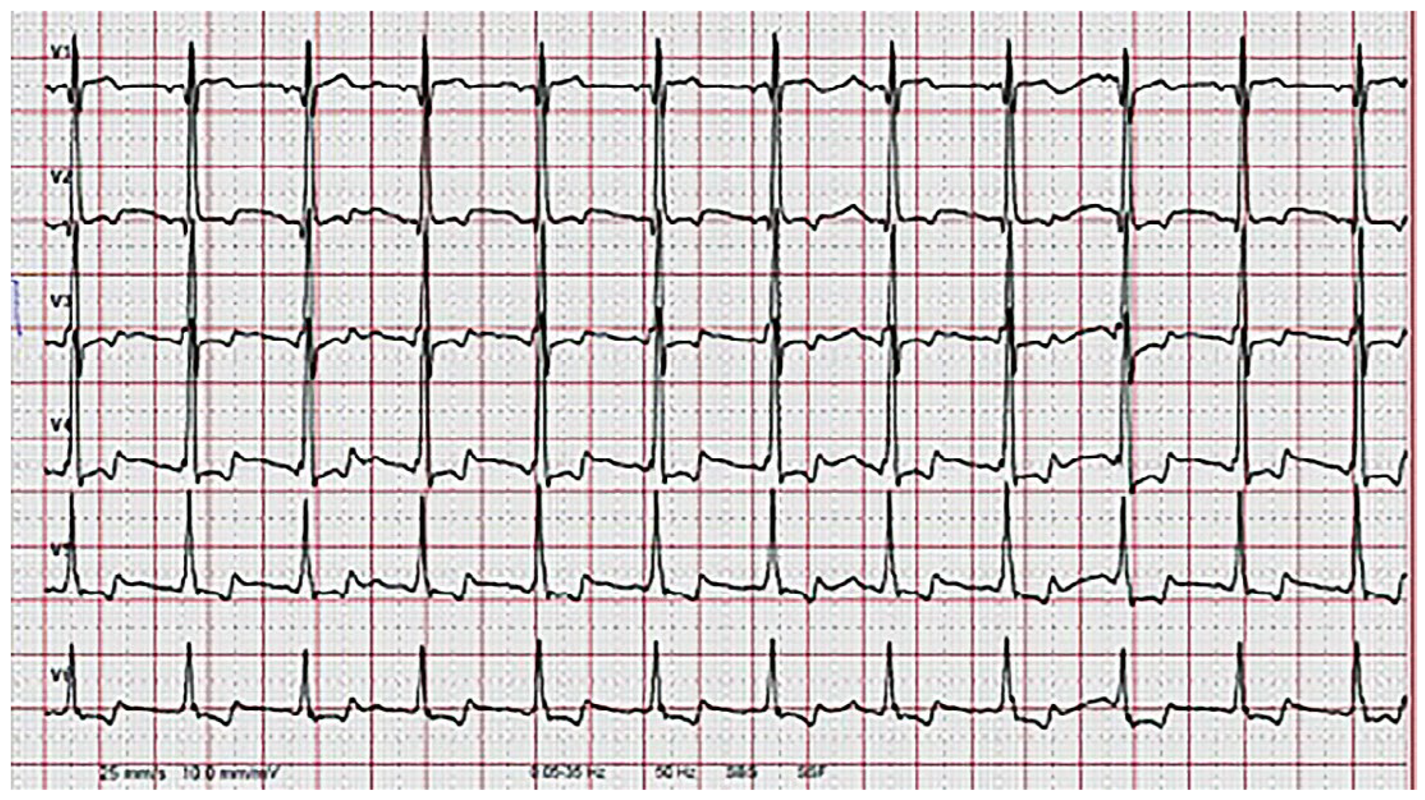 Cardiovascmed 21 00212 g006 Cardiovascmed 21 00212 g006