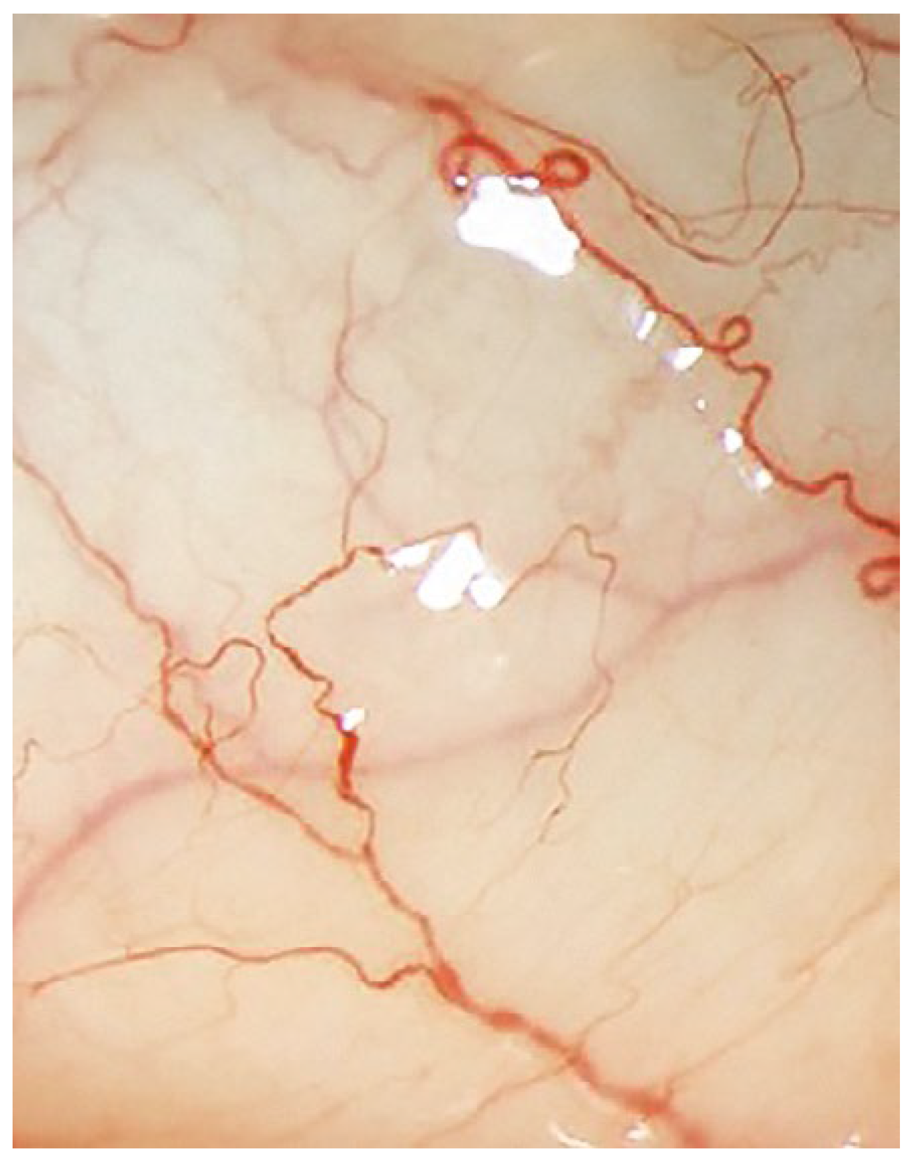 Cardiovascmed 21 00212 g007 Cardiovascmed 21 00212 g007