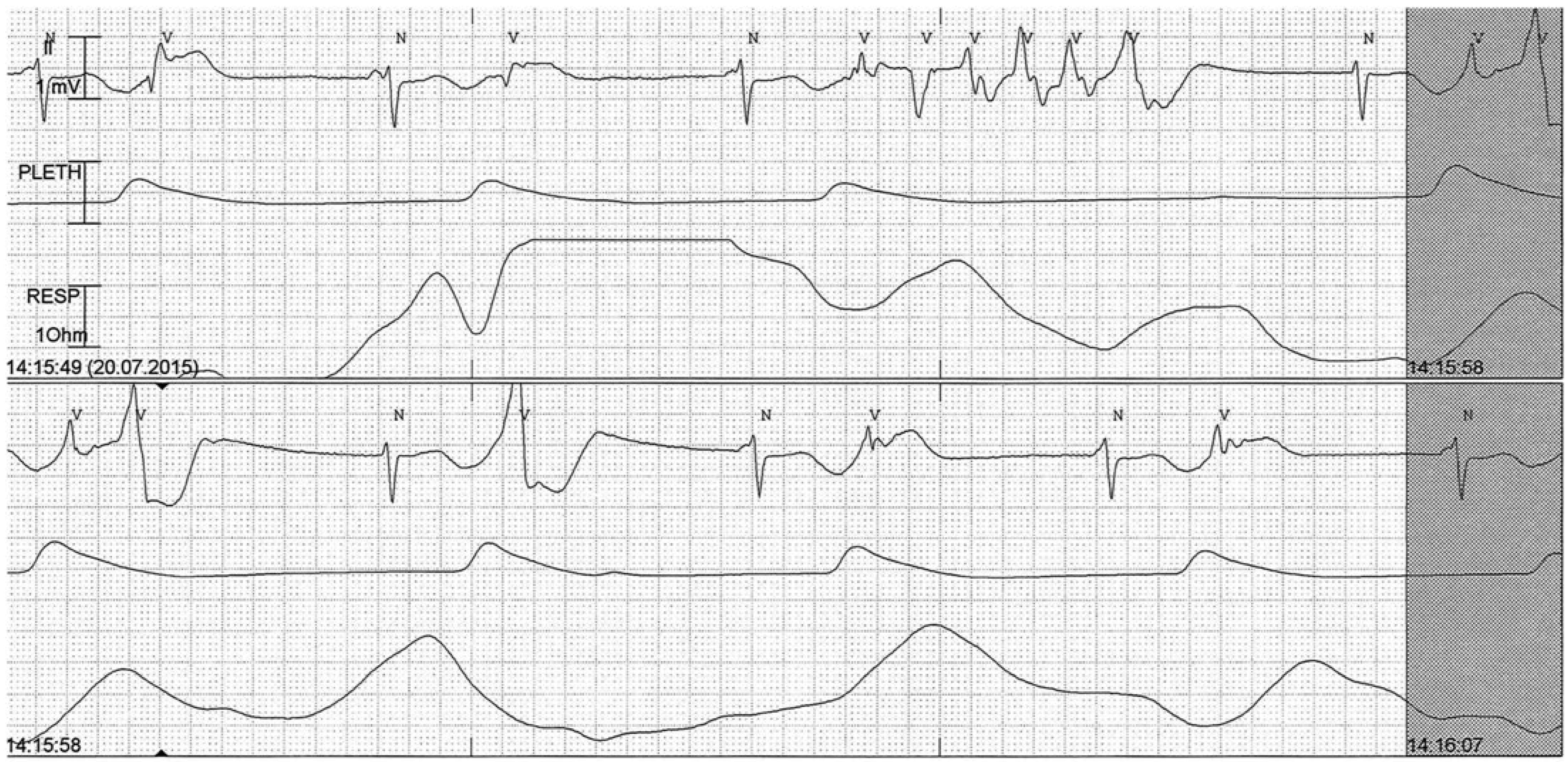 Cardiovascmed 21 00218 g001 Cardiovascmed 21 00218 g001