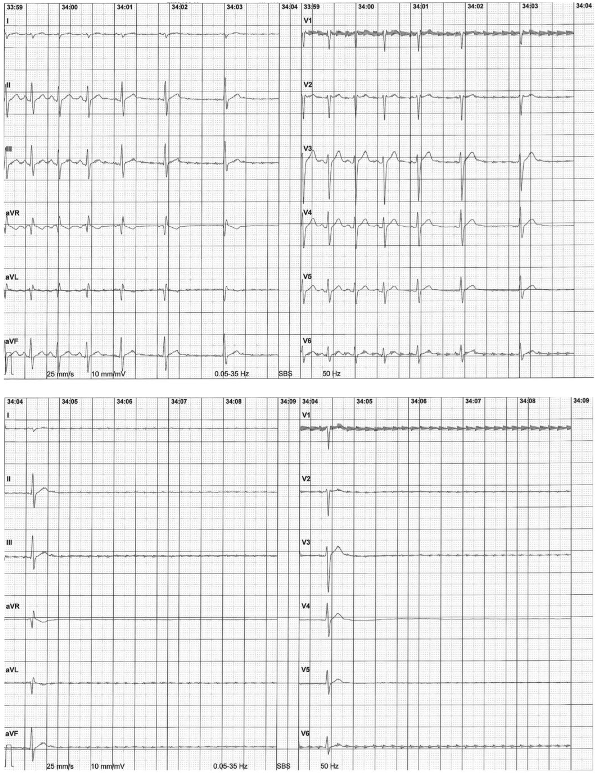Cardiovascmed 21 00218 g002 Cardiovascmed 21 00218 g002