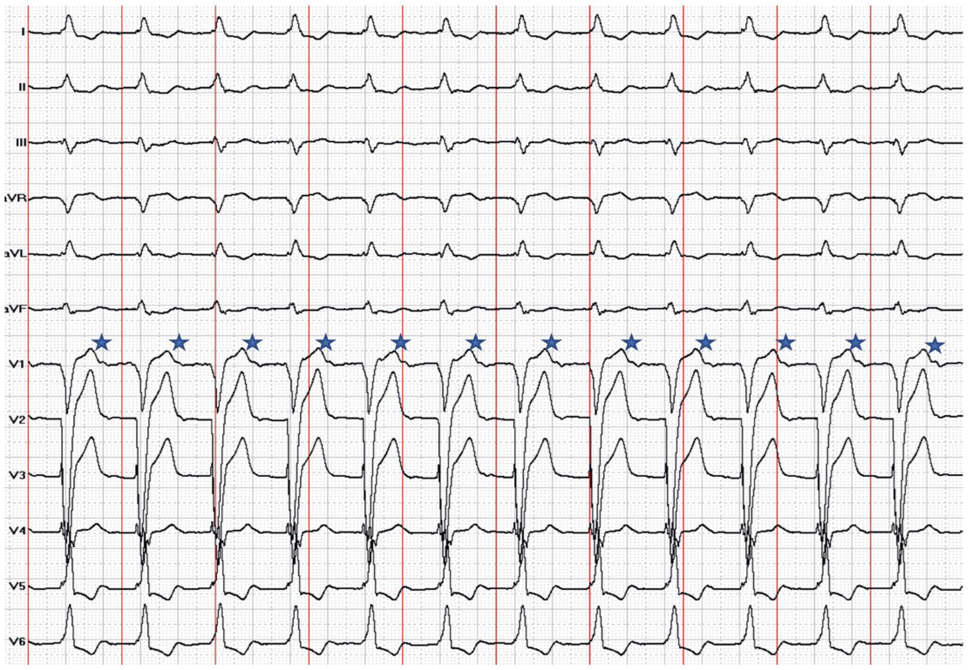 Cardiovascmed 21 00218 g003 Cardiovascmed 21 00218 g003