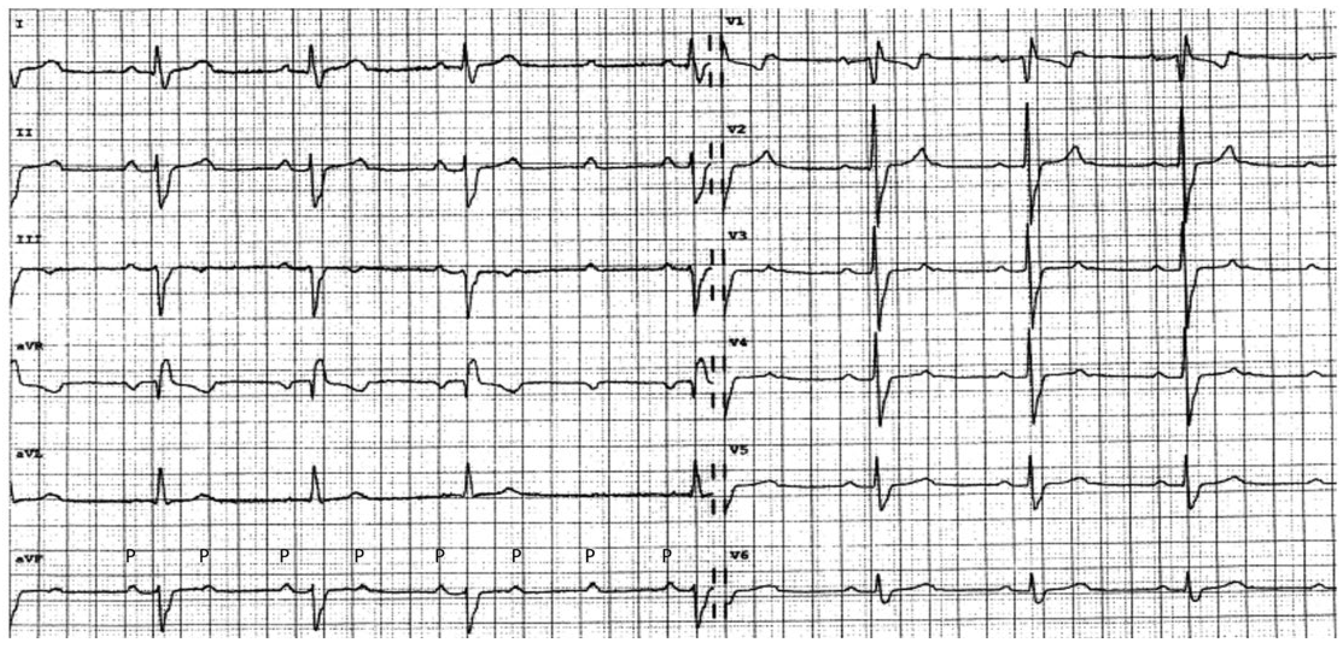 Cardiovascmed 21 00218 g004 Cardiovascmed 21 00218 g004