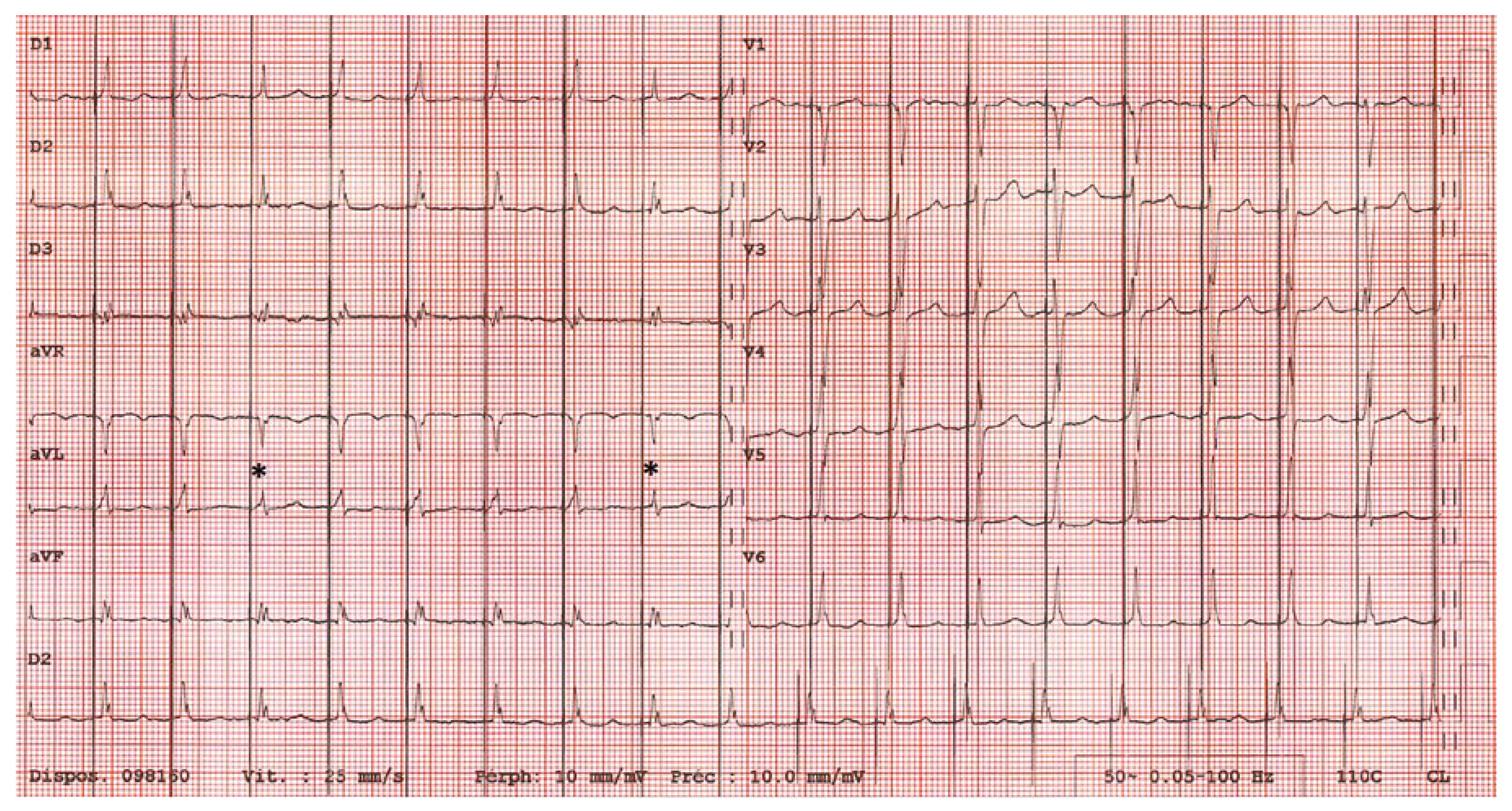 Cardiovascmed 21 00249 g003