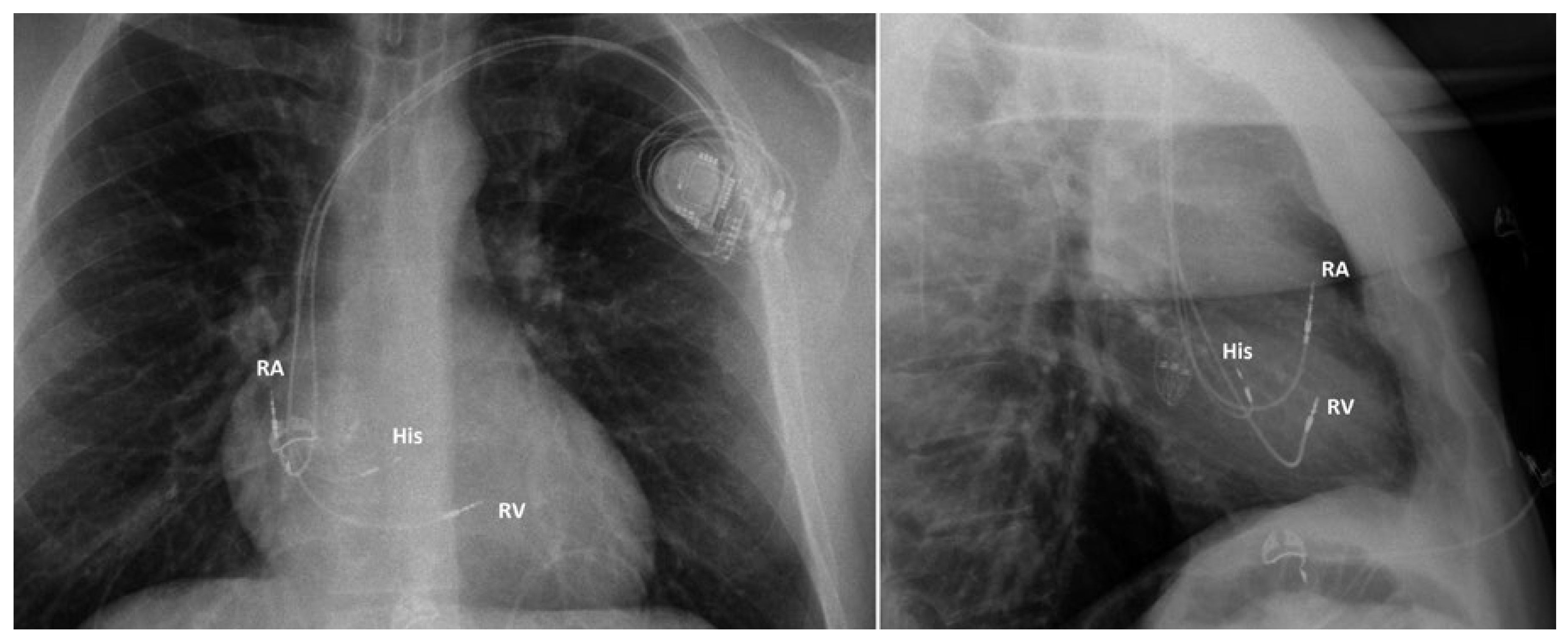 Cardiovascmed 21 00249 g005