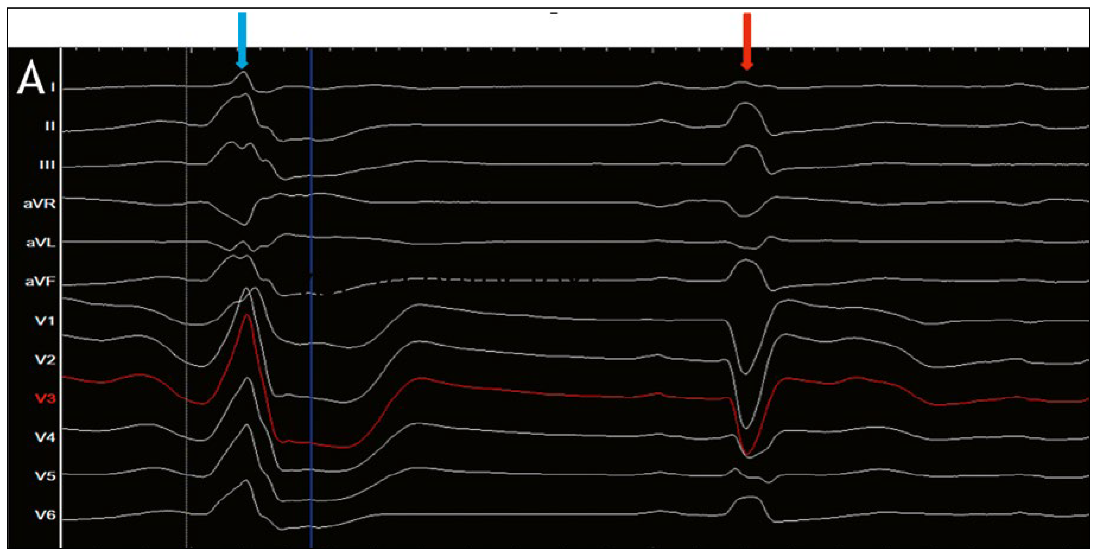 Cardiovascmed 21 00255 g001a