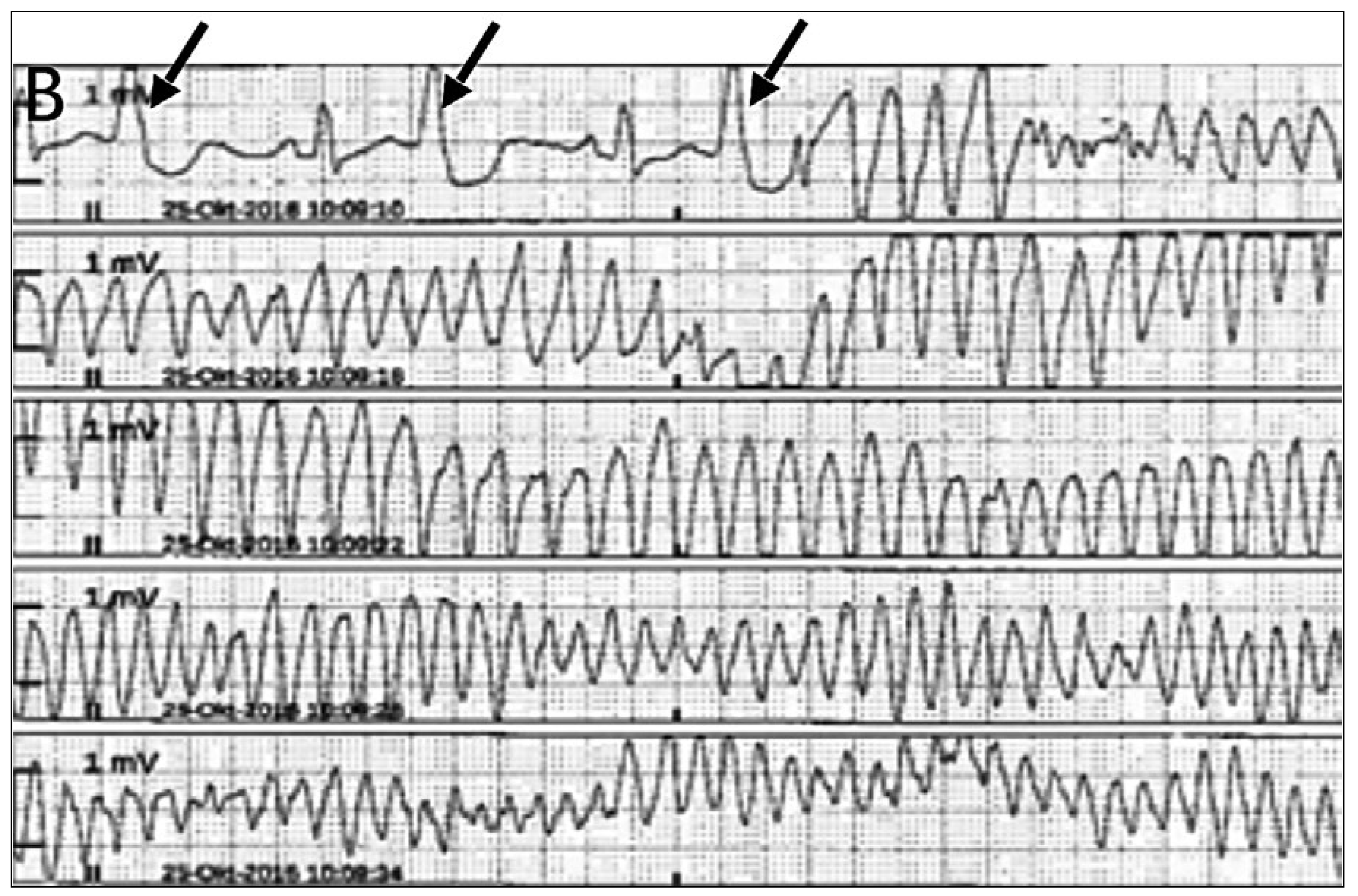 Cardiovascmed 21 00255 g001b
