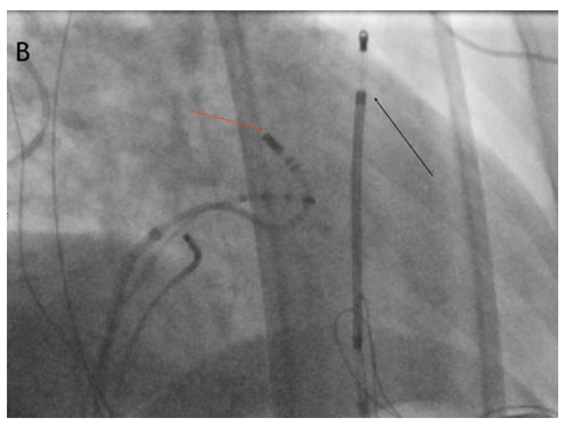 Cardiovascmed 21 00255 g002b