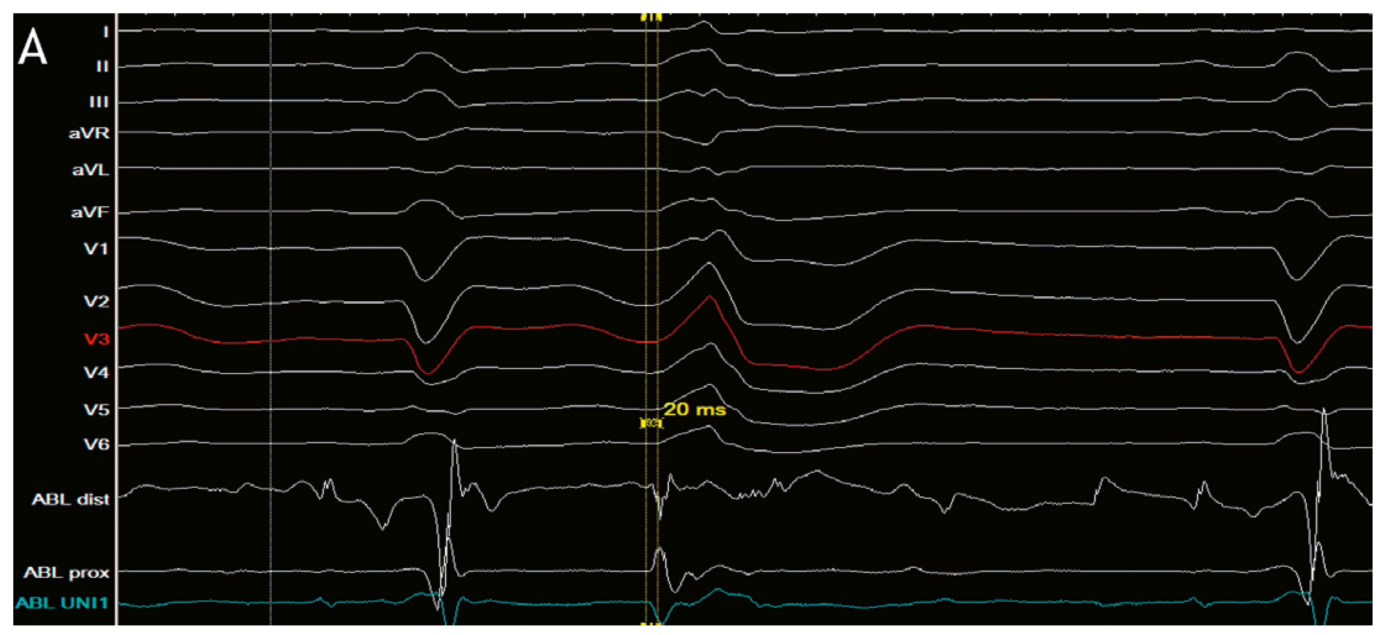 Cardiovascmed 21 00255 g003a