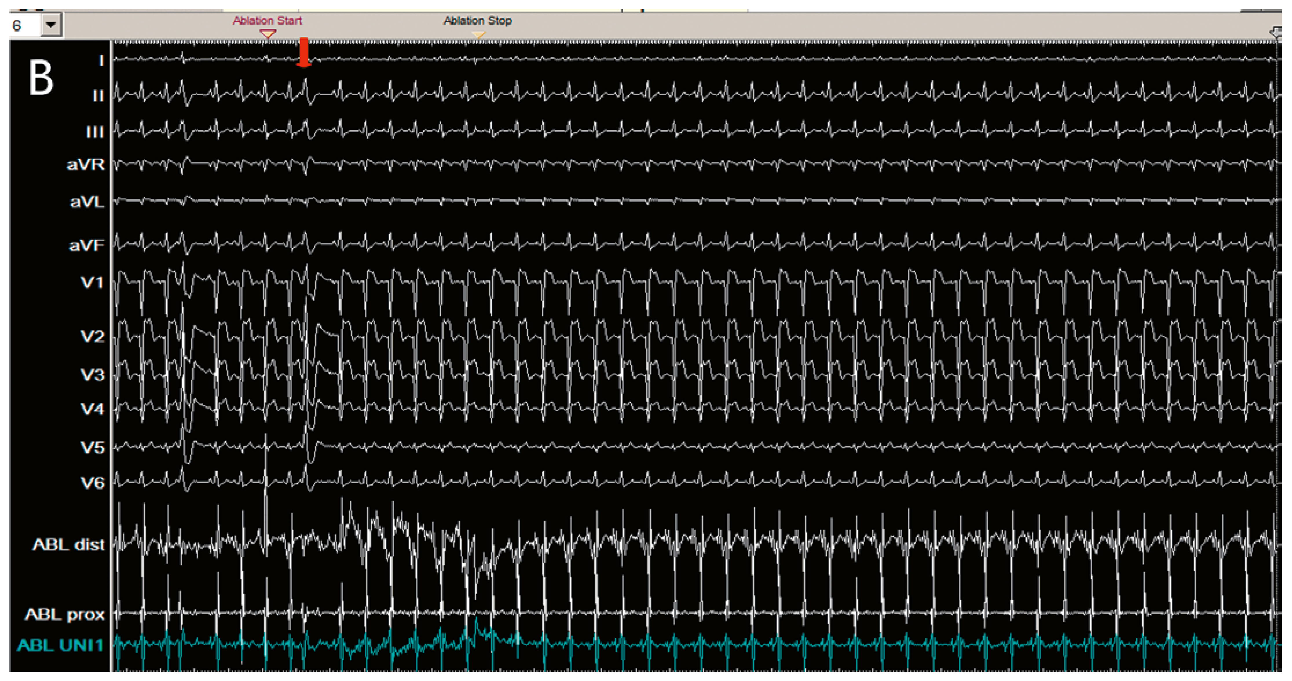 Cardiovascmed 21 00255 g003b