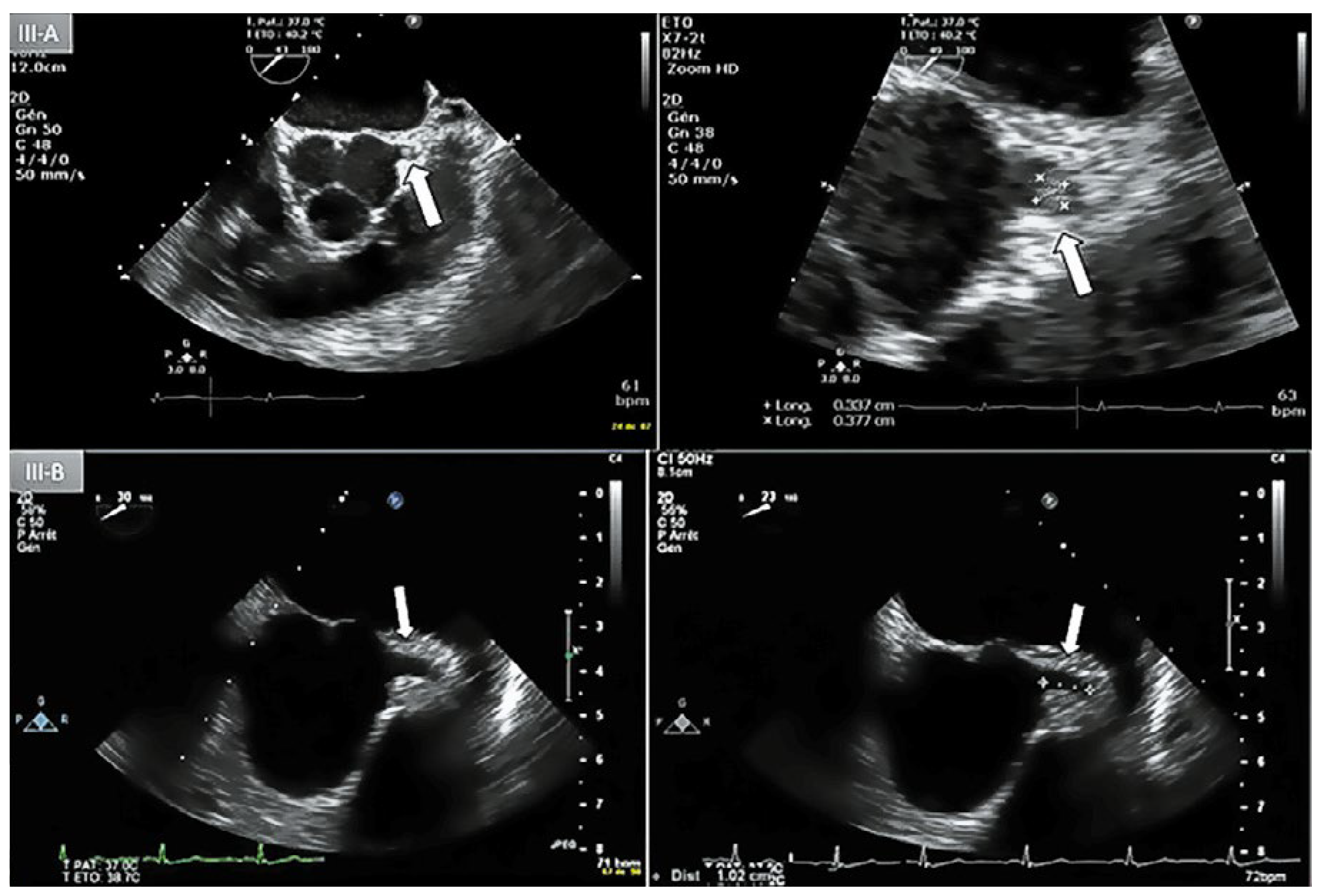 Cardiovascmed 21 00259 g003