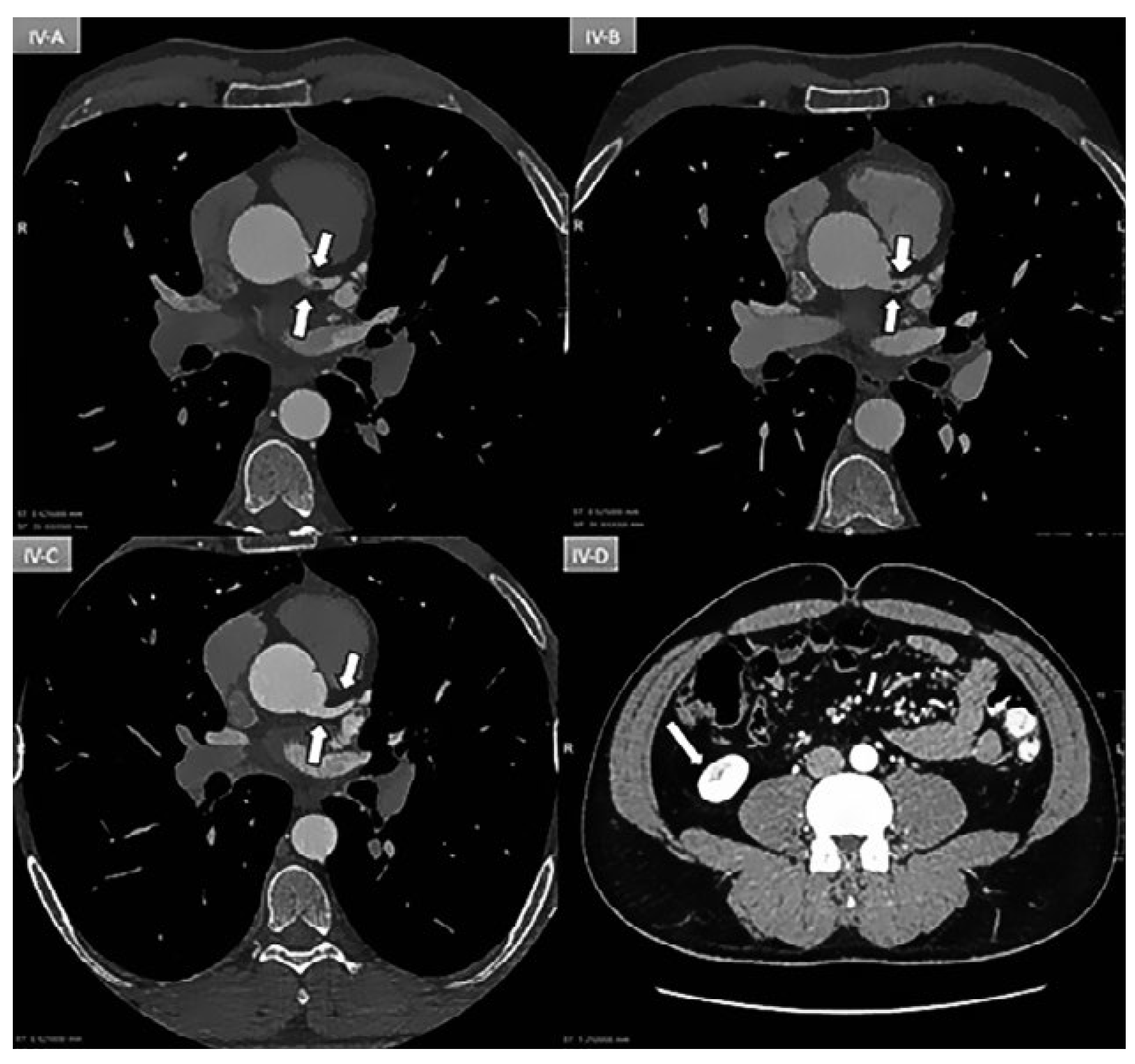 Cardiovascmed 21 00259 g004