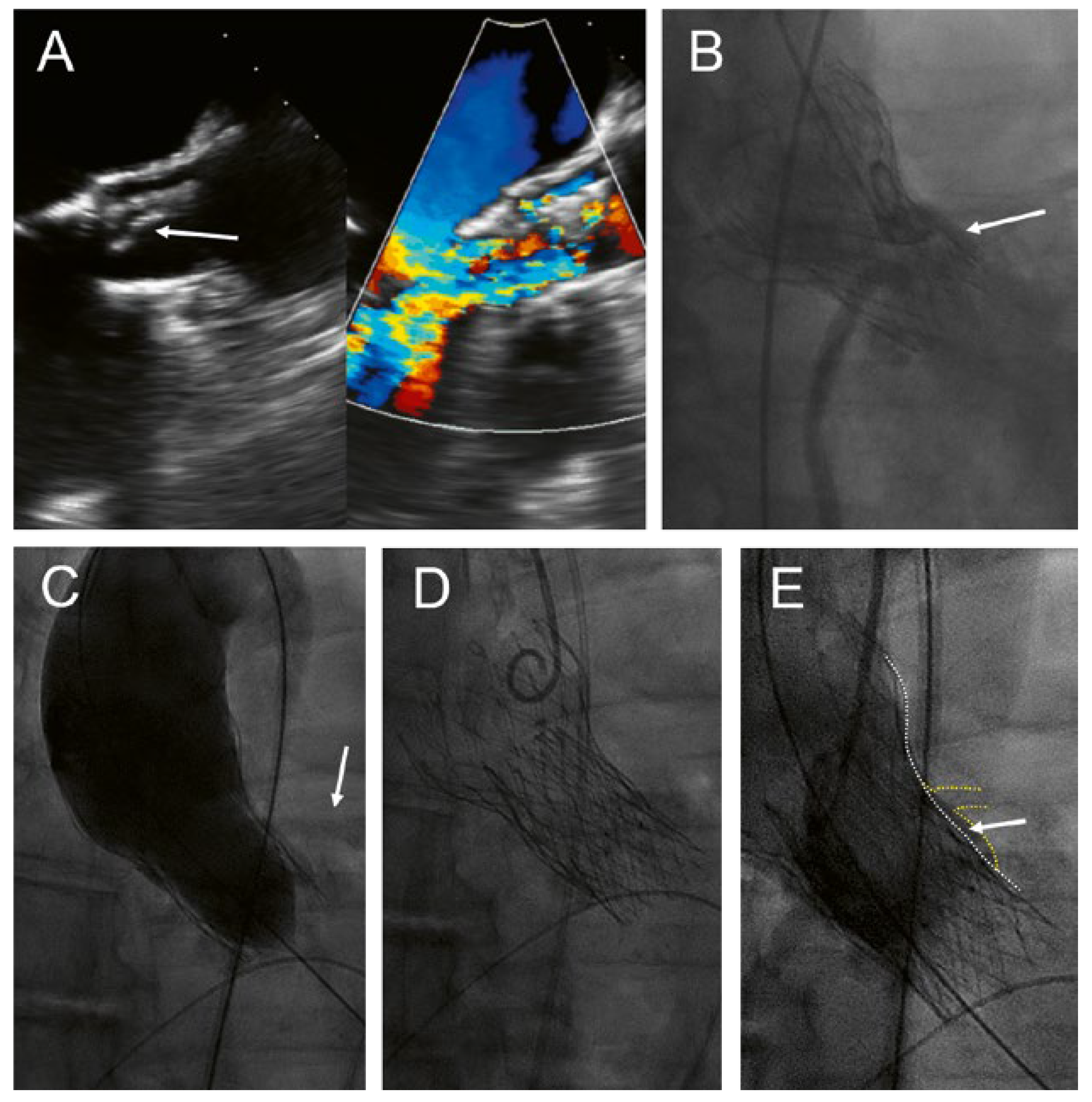 Cardiovascmed 21 00262 g001