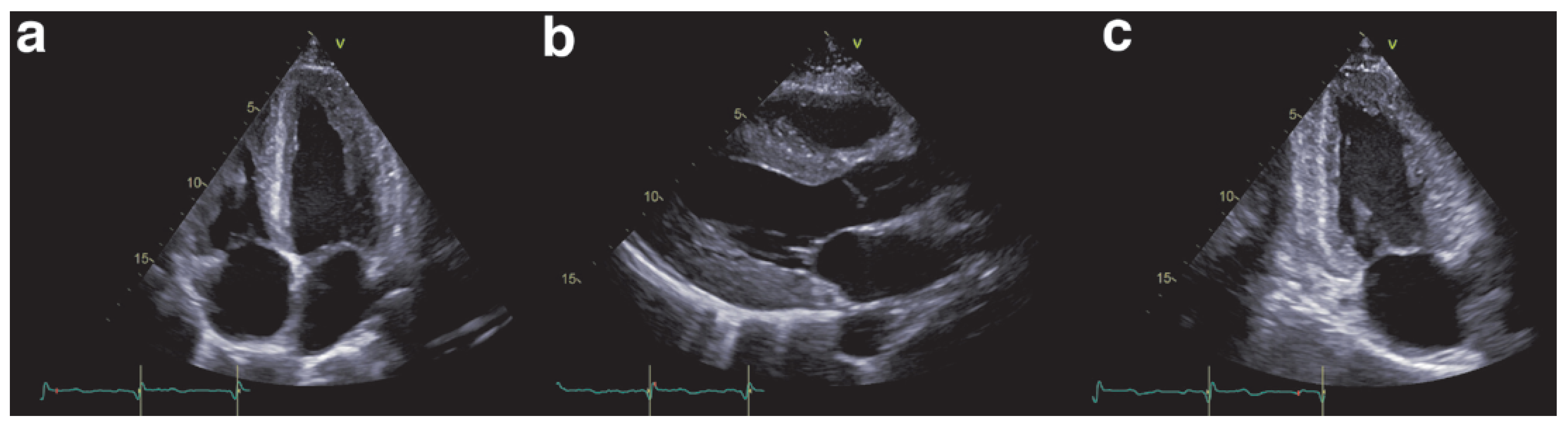 Cardiovascmed 21 00282 g002 Cardiovascmed 21 00282 g002