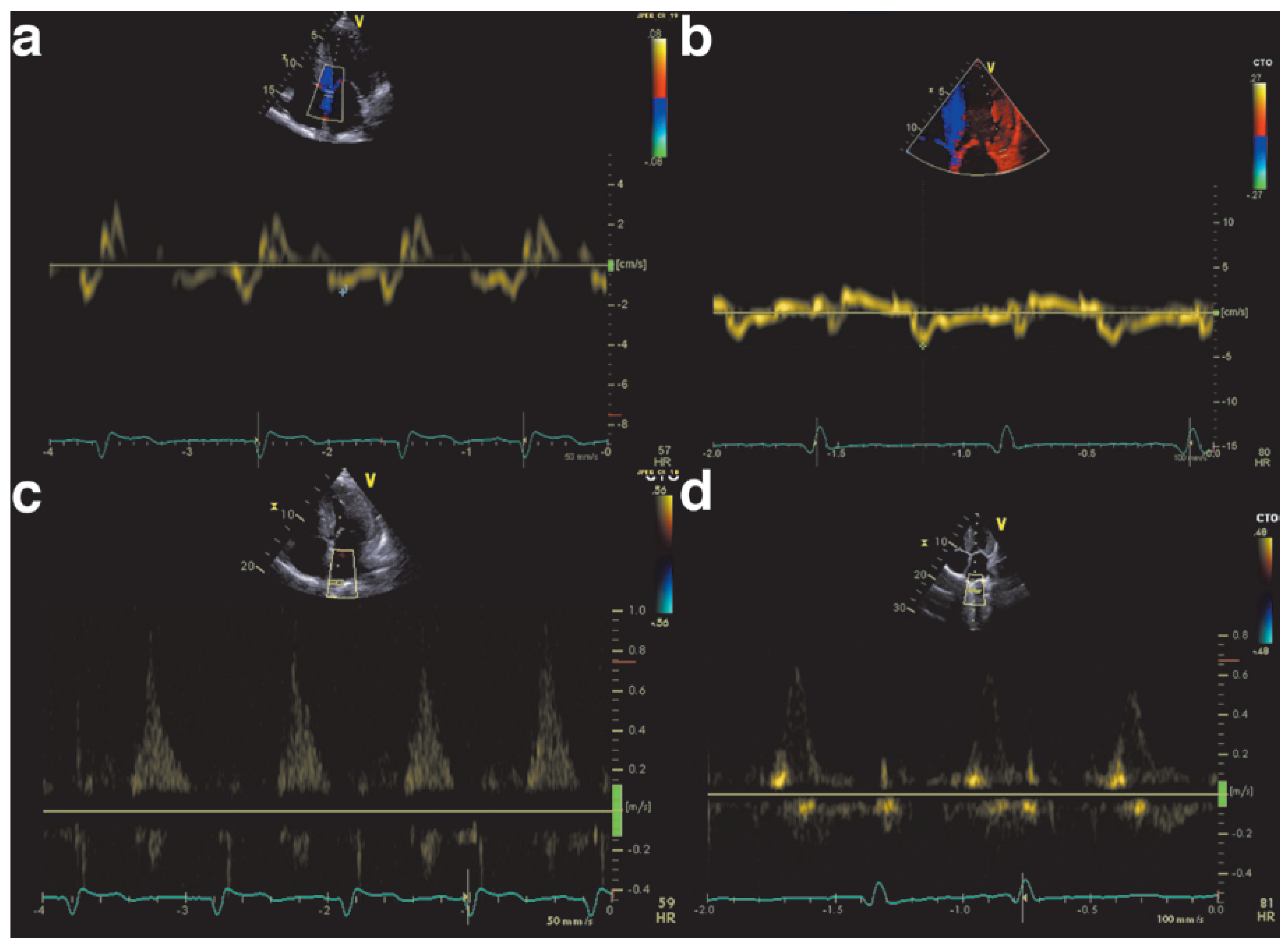Cardiovascmed 21 00282 g003 Cardiovascmed 21 00282 g003