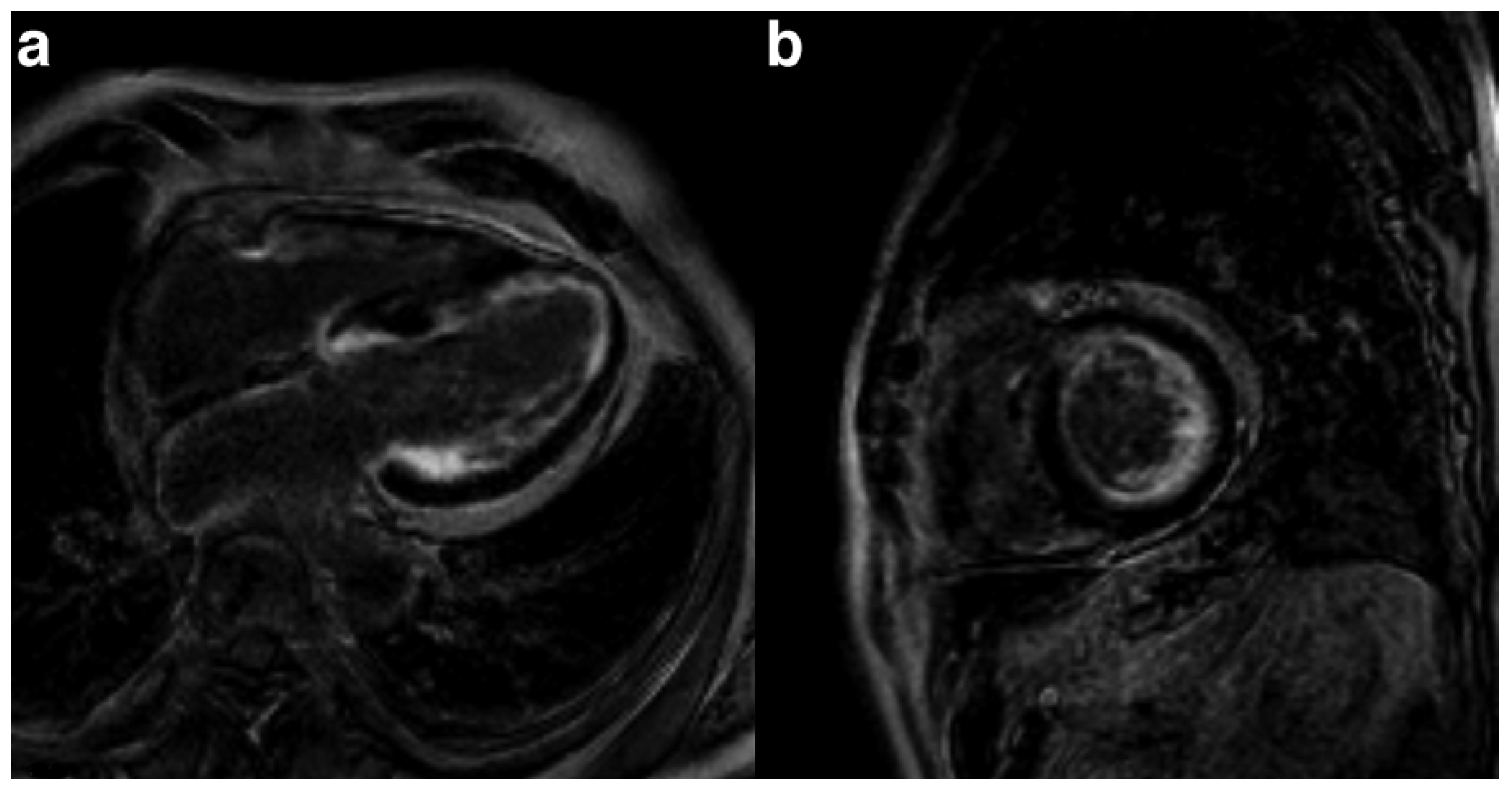 Cardiovascmed 21 00282 g005 Cardiovascmed 21 00282 g005