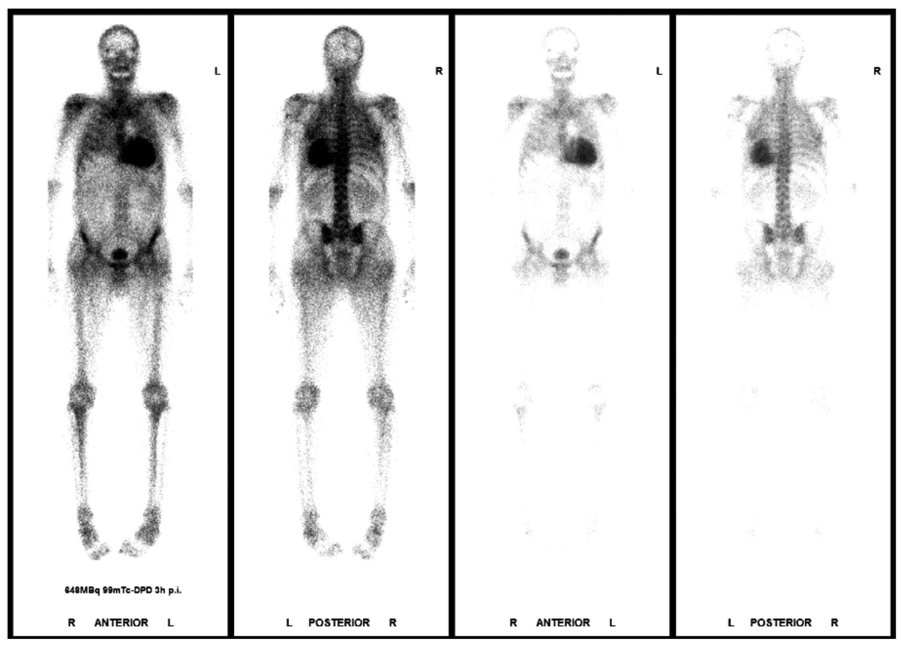 Cardiovascmed 21 00282 g007 Cardiovascmed 21 00282 g007