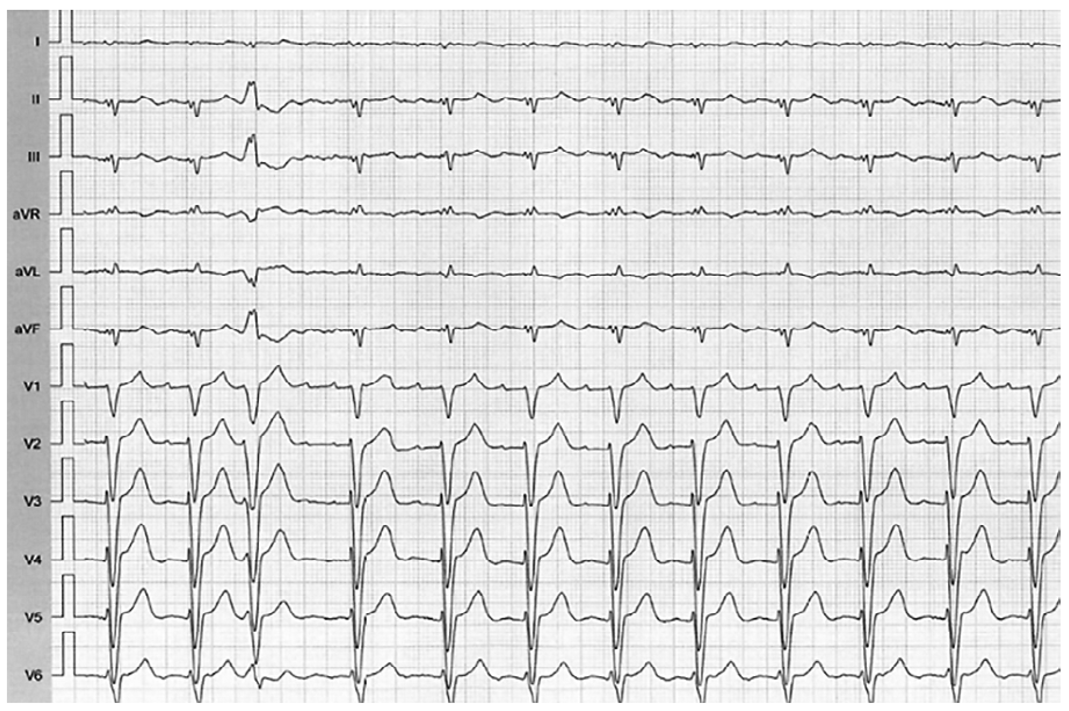 Cardiovascmed 21 00296 g001 Cardiovascmed 21 00296 g001